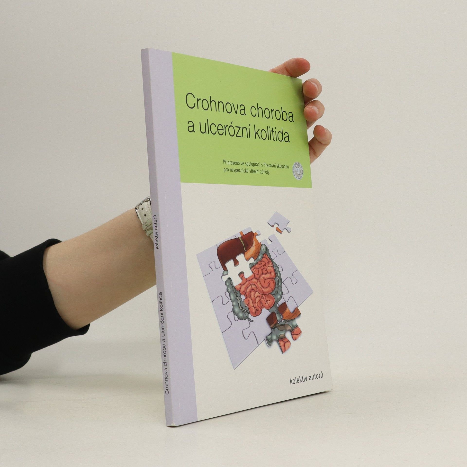 Auteurscollectief Crohnova choroba a ulcerózní kolitida