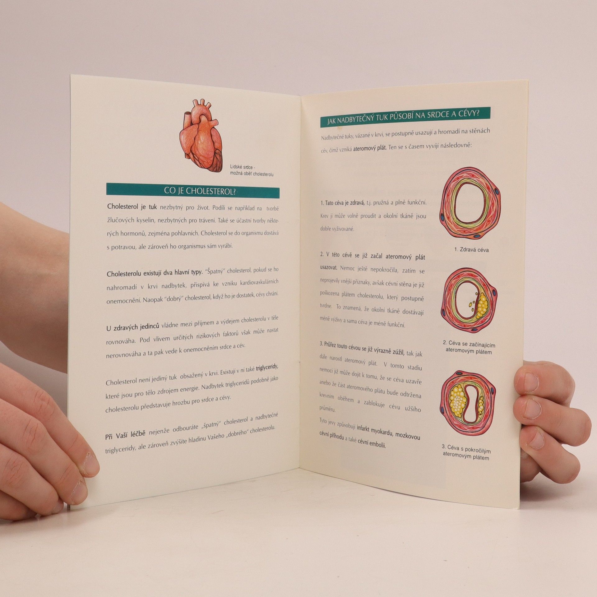Autorenkollektiv Cholesterol. Jak ho můžete ovlivnit?