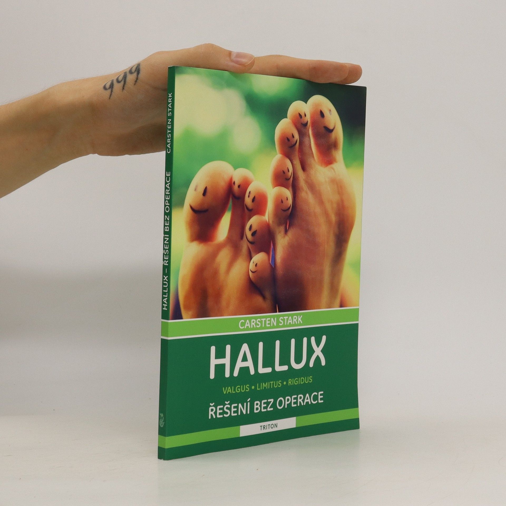 Carsten Stark Hallux – řešení bez operace