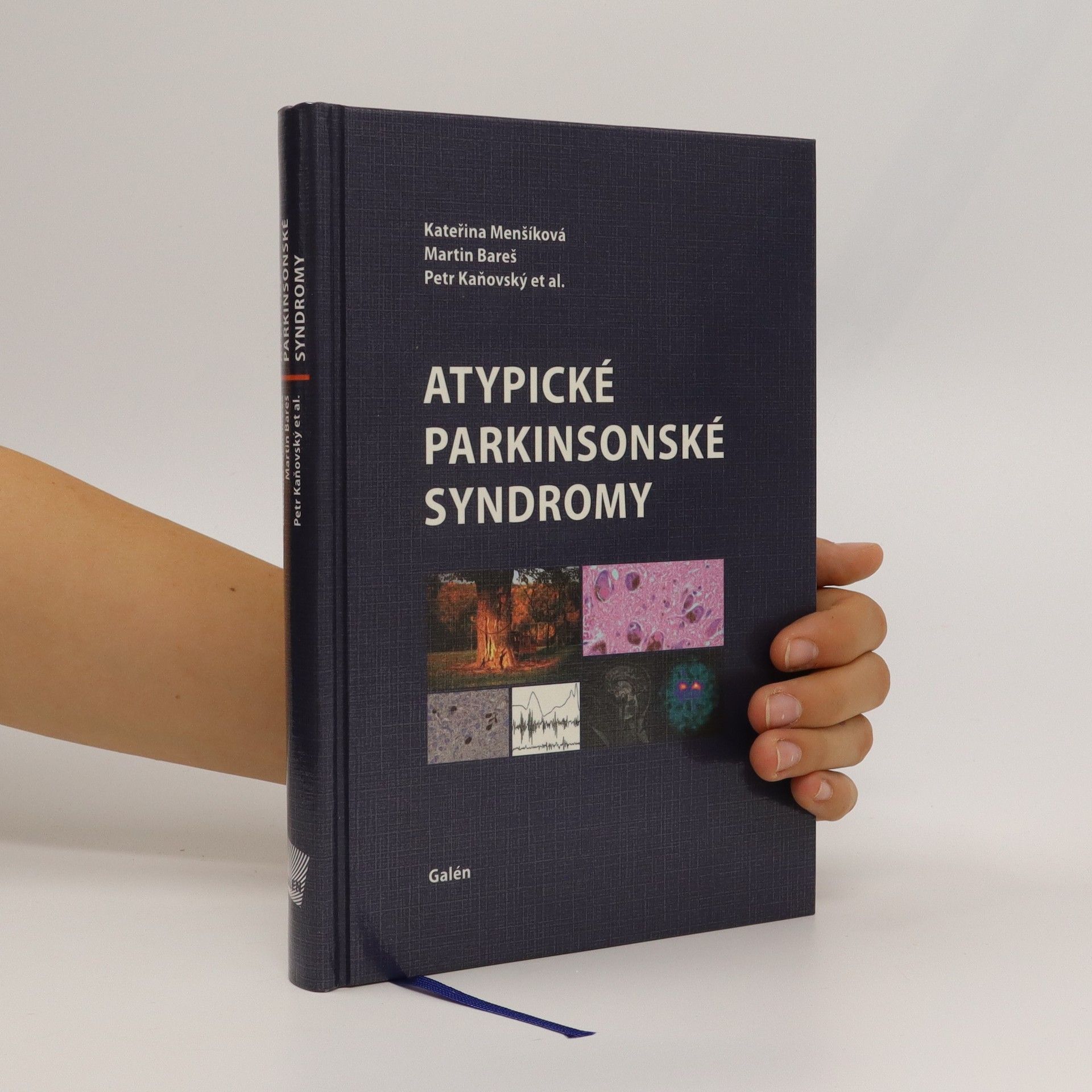 Martin Bareš Atypické parkinsonské syndromy