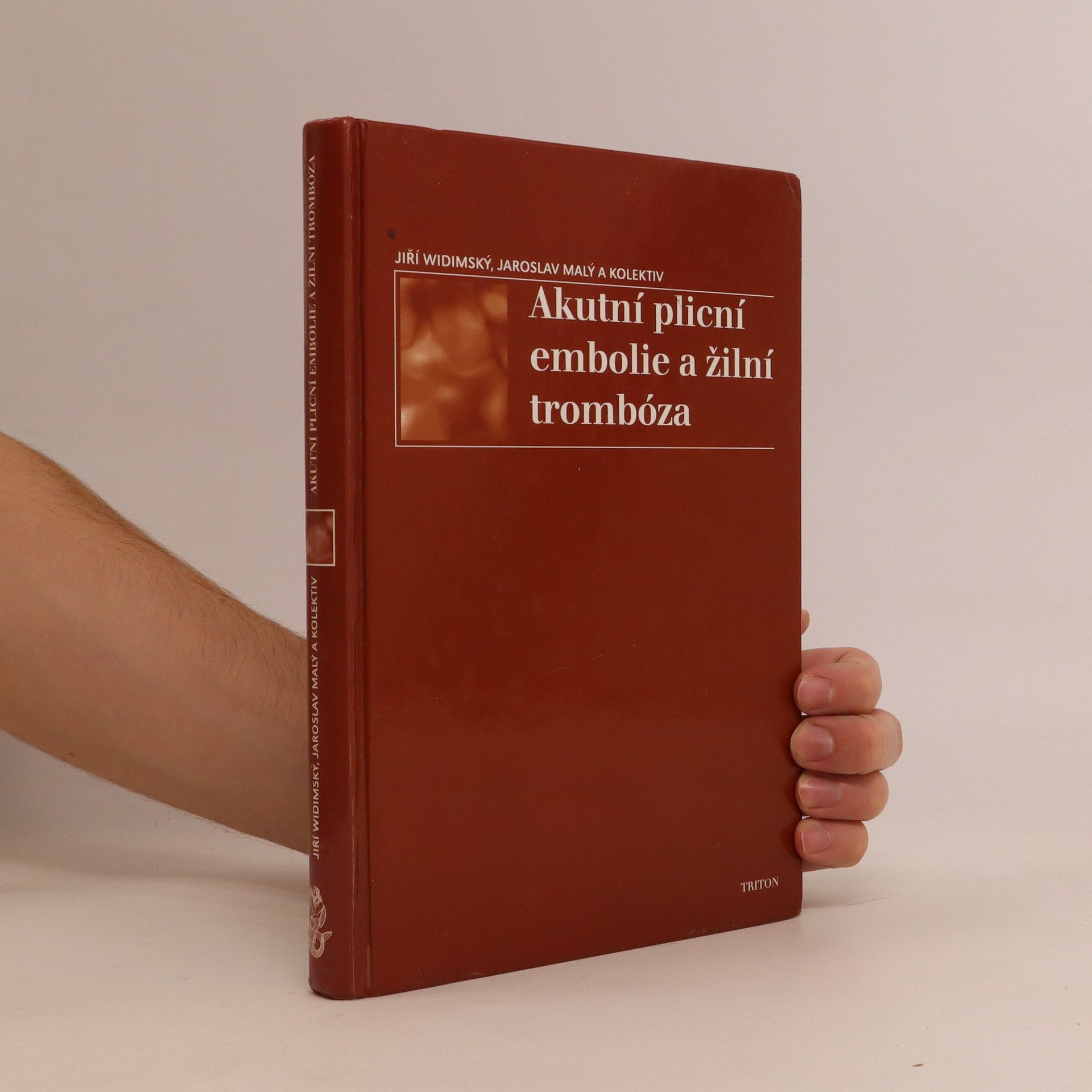 Jiří Widimský Akutní plicní embolie a žilní trombóza