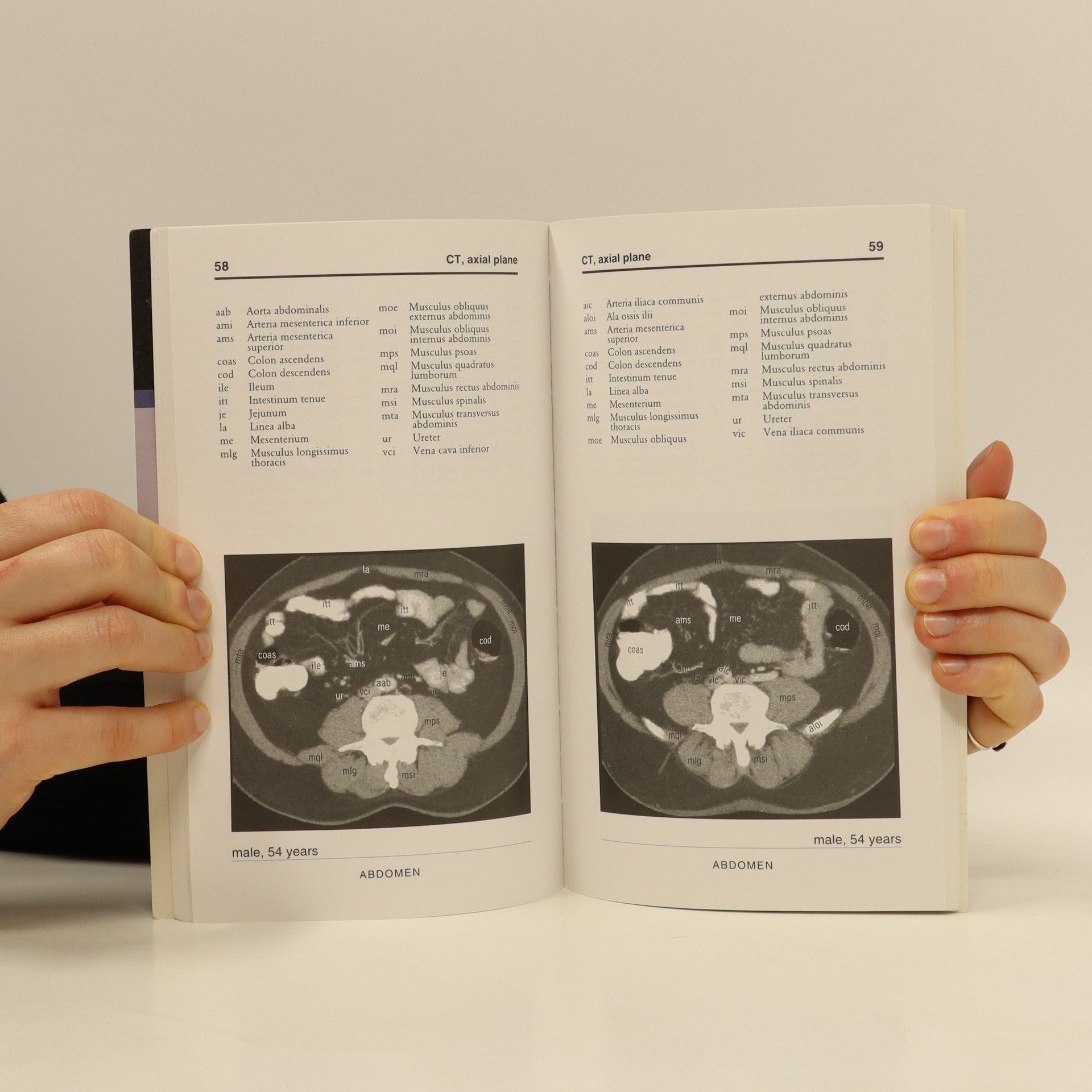 Jiří Neuwirth Anatomia Radiologica Abdominalis Basalis