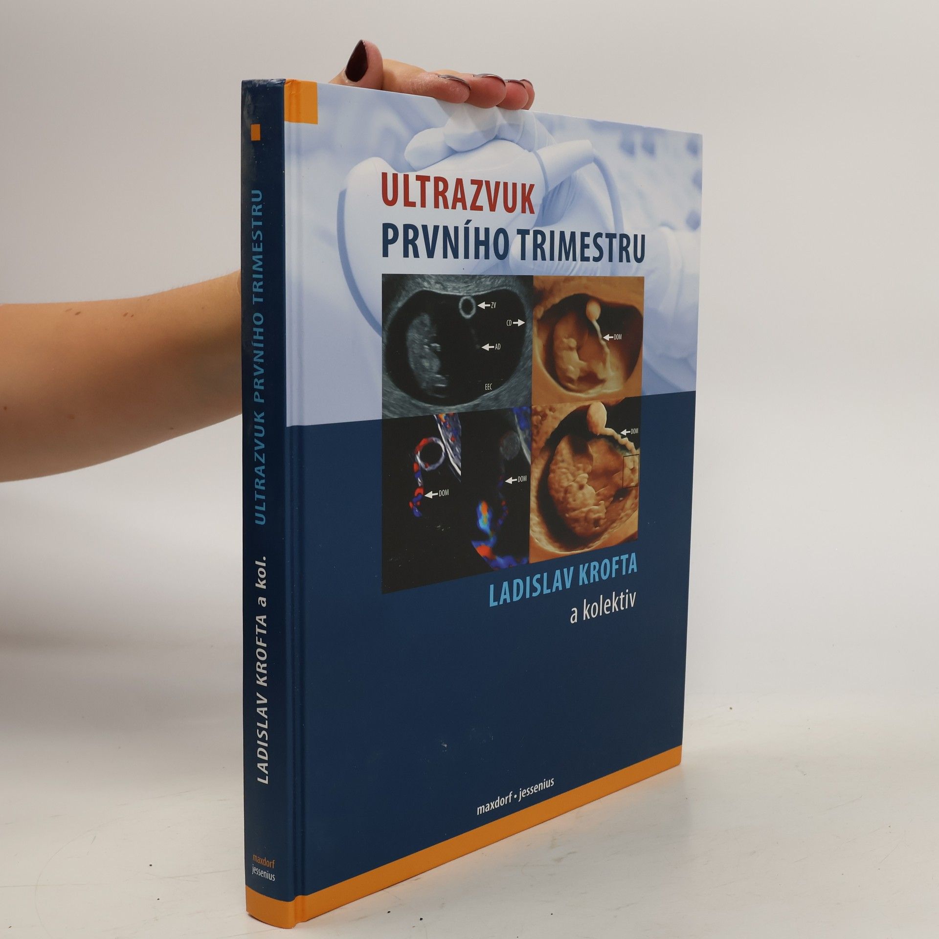 Ladislav Krofta Ultrazvuk prvního trimestru