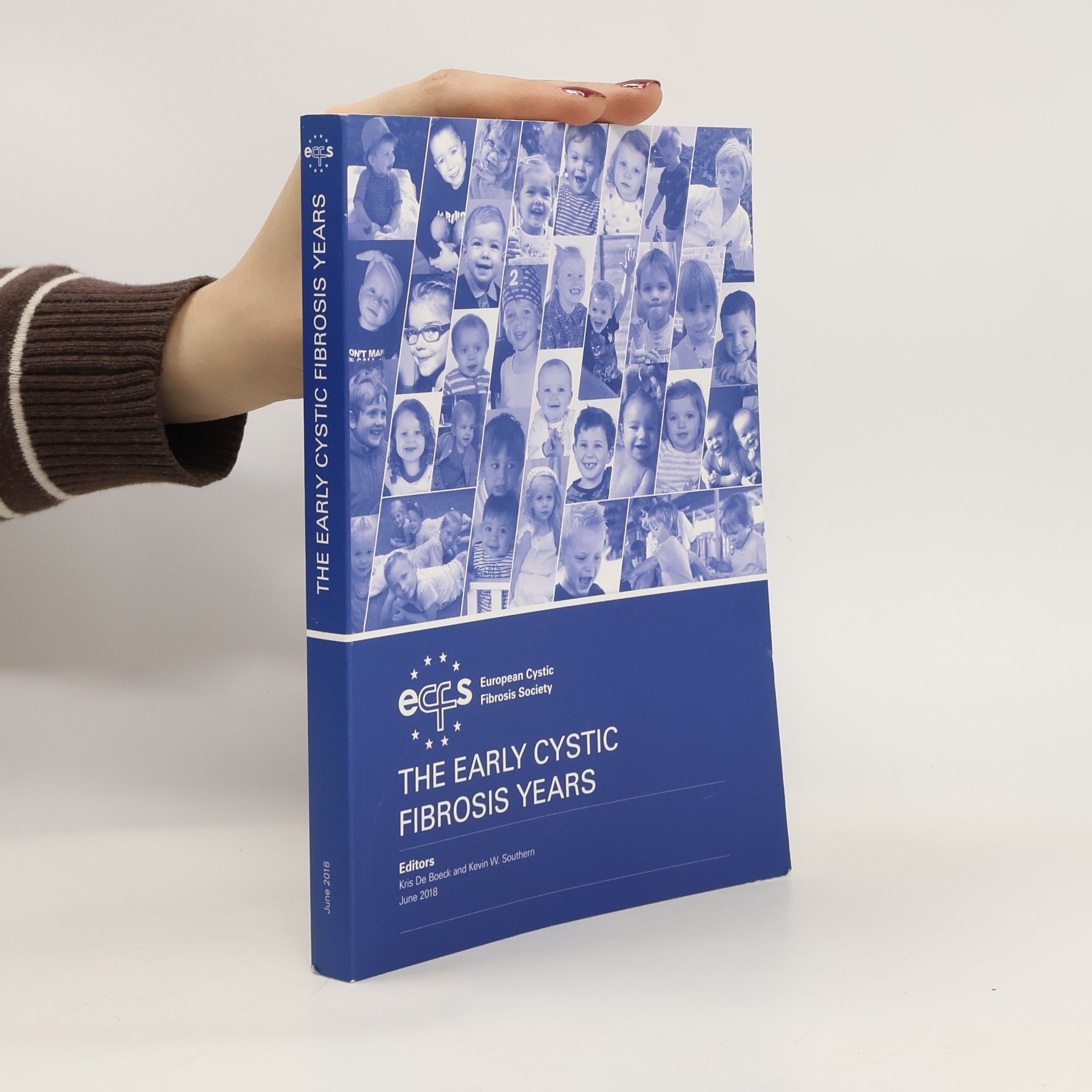 Collectif d'auteurs The Early Cystic Fibrosis Years