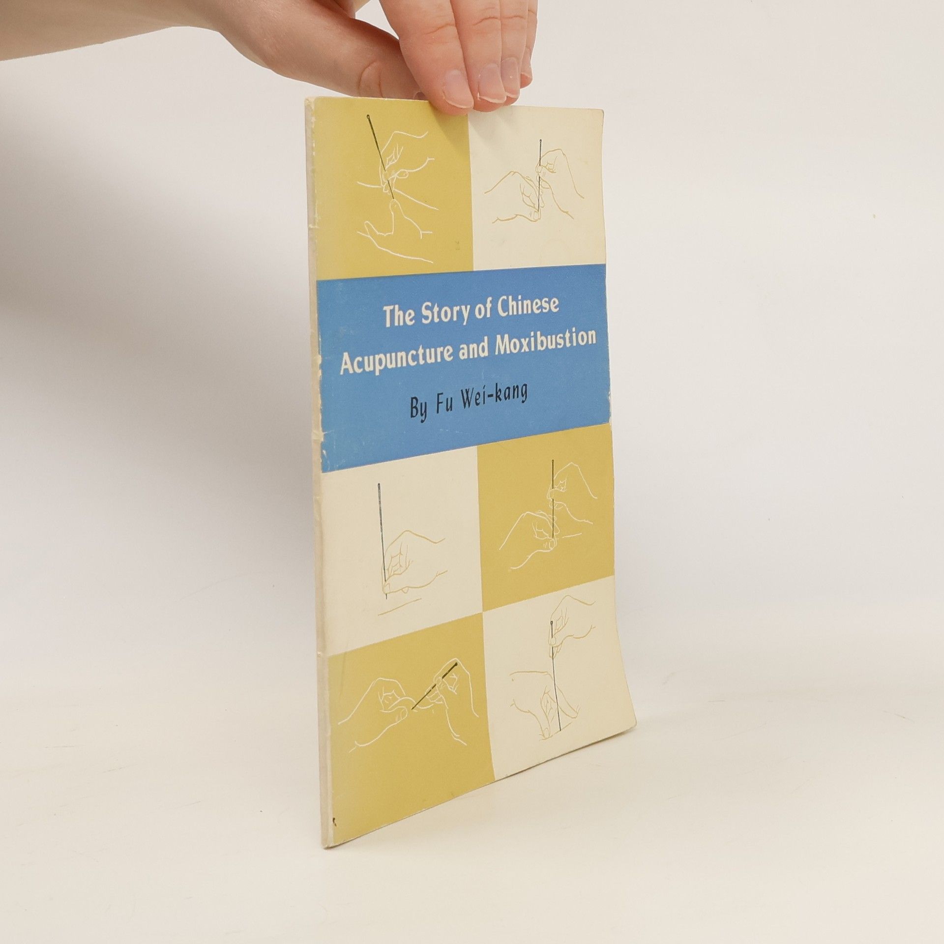 Fu Wei-kang The Story of Chinese Acupuncture and Moxibustion