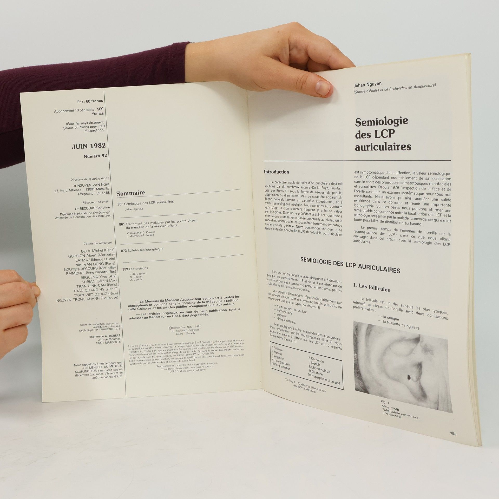 Autorenkollektiv Le Mensuel du Médecin Acupuncteur 93/1982