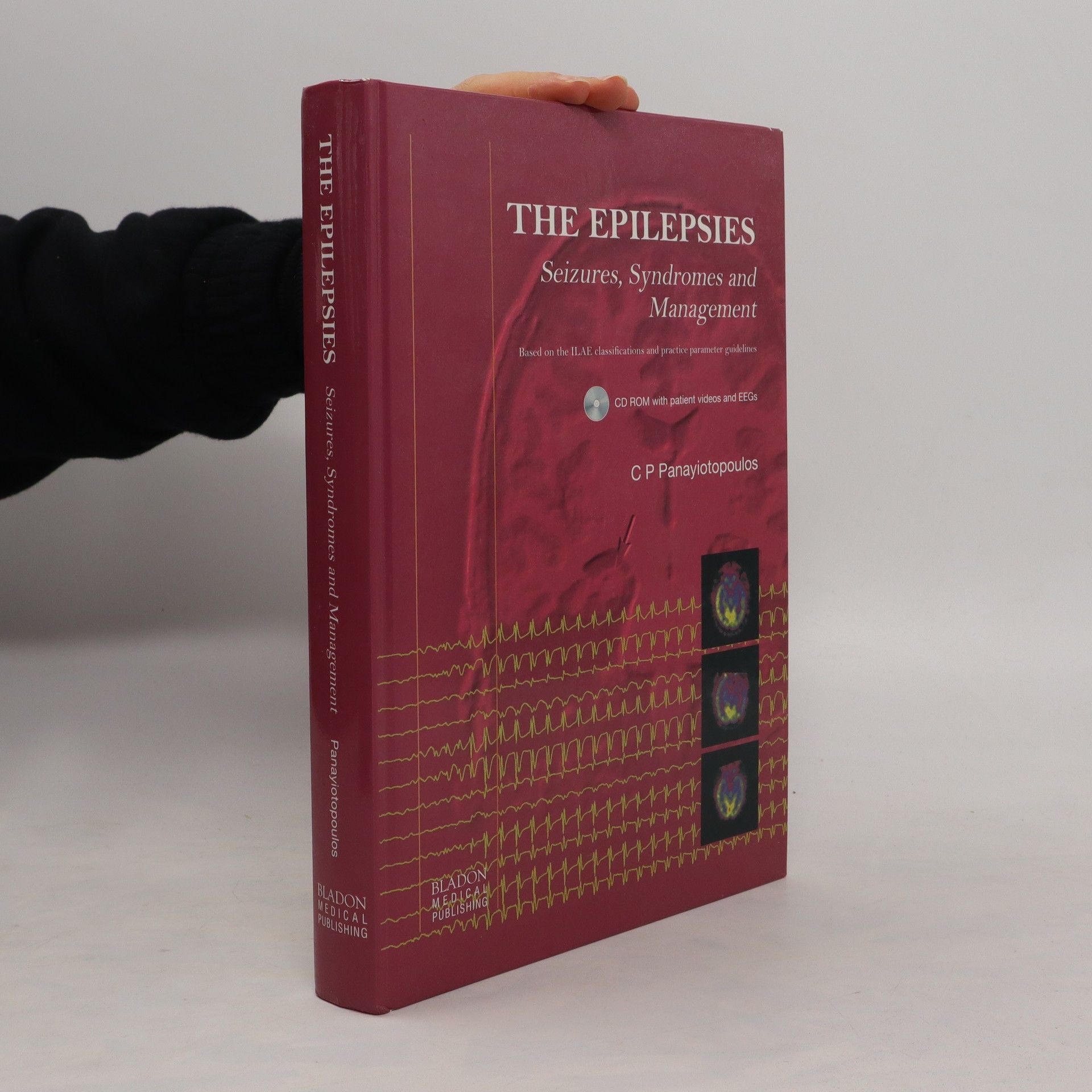 Collectif d'auteurs The Epilepsies