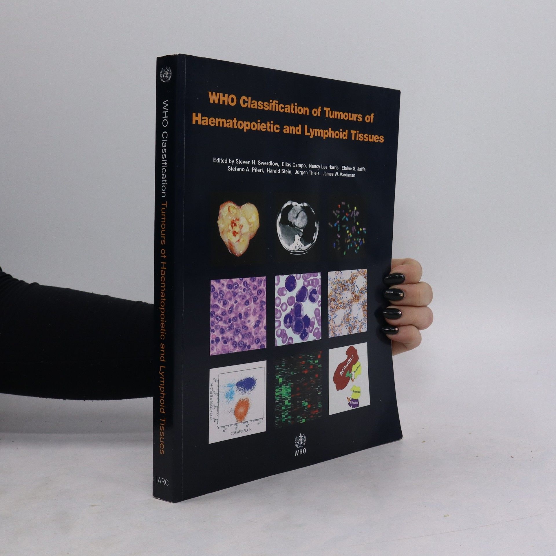 AA.VV. WHO classification of tumours of haematopoietic and lymphoid tissues
