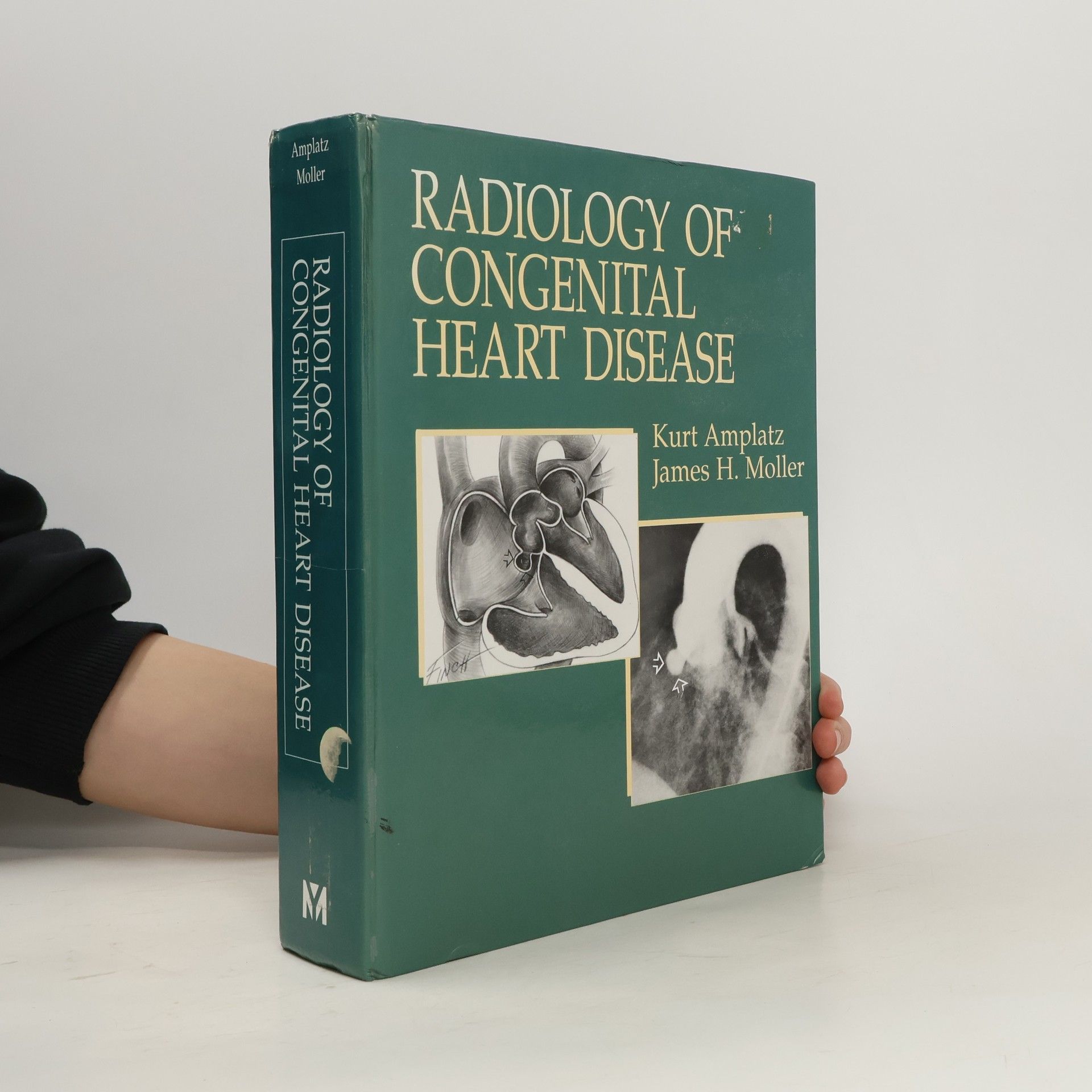 Kurt Amplatz Radiology of Congenital Heart Disease