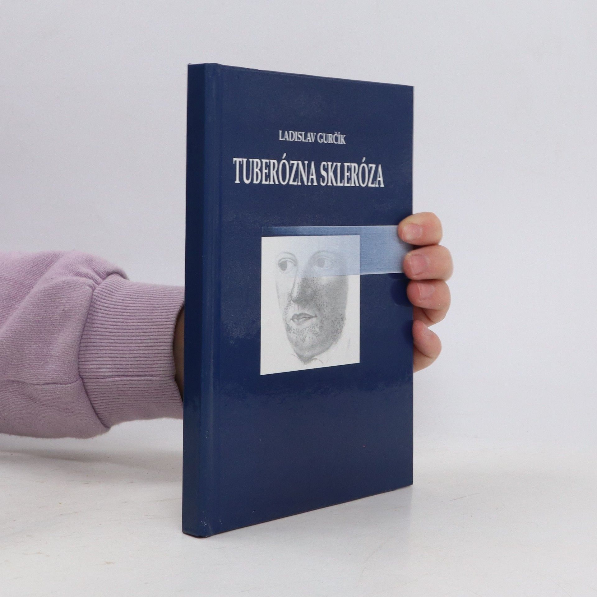 Ladislav Gurčík Tuberózna skleróza