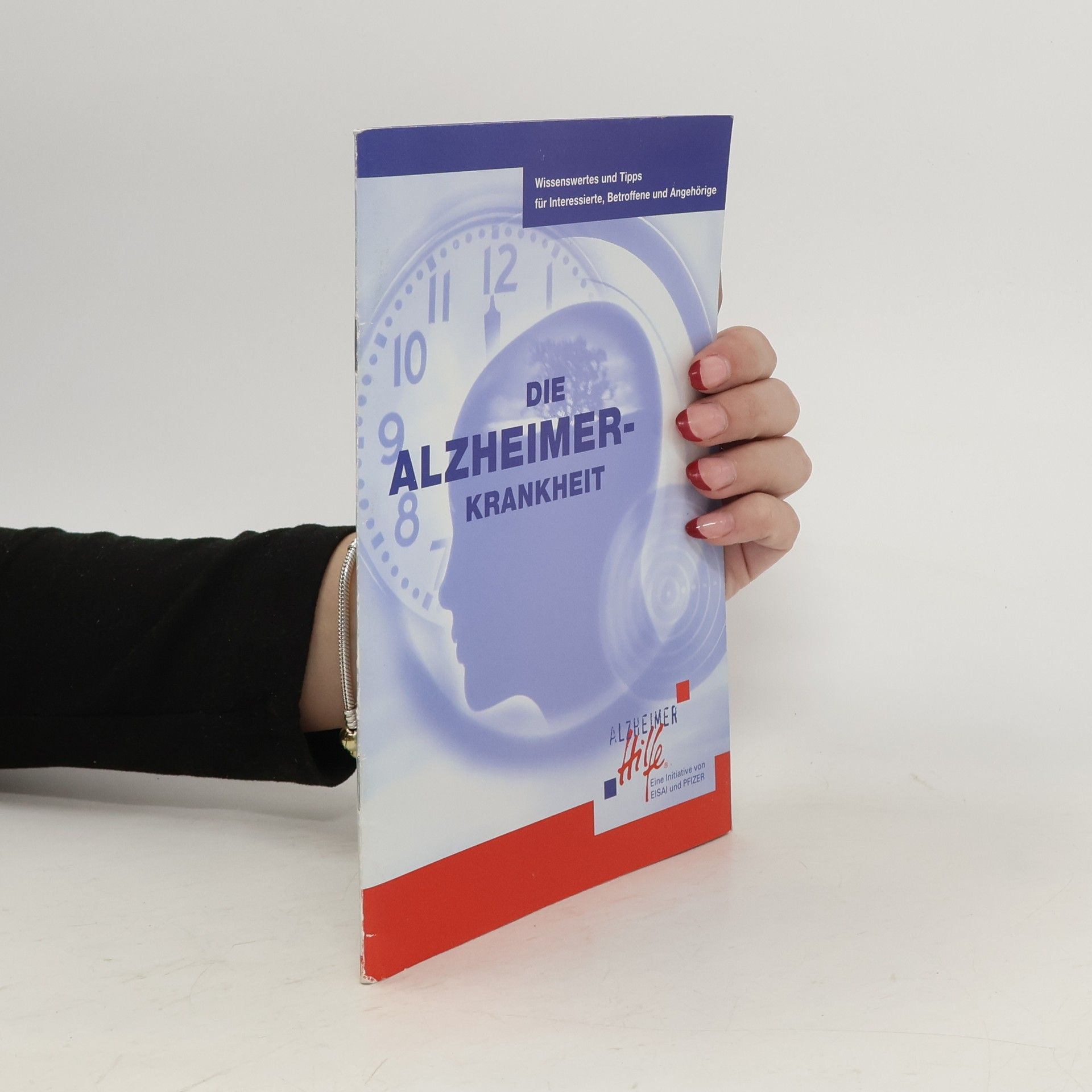 Auteurscollectief Die Alzheimer-Krankheit