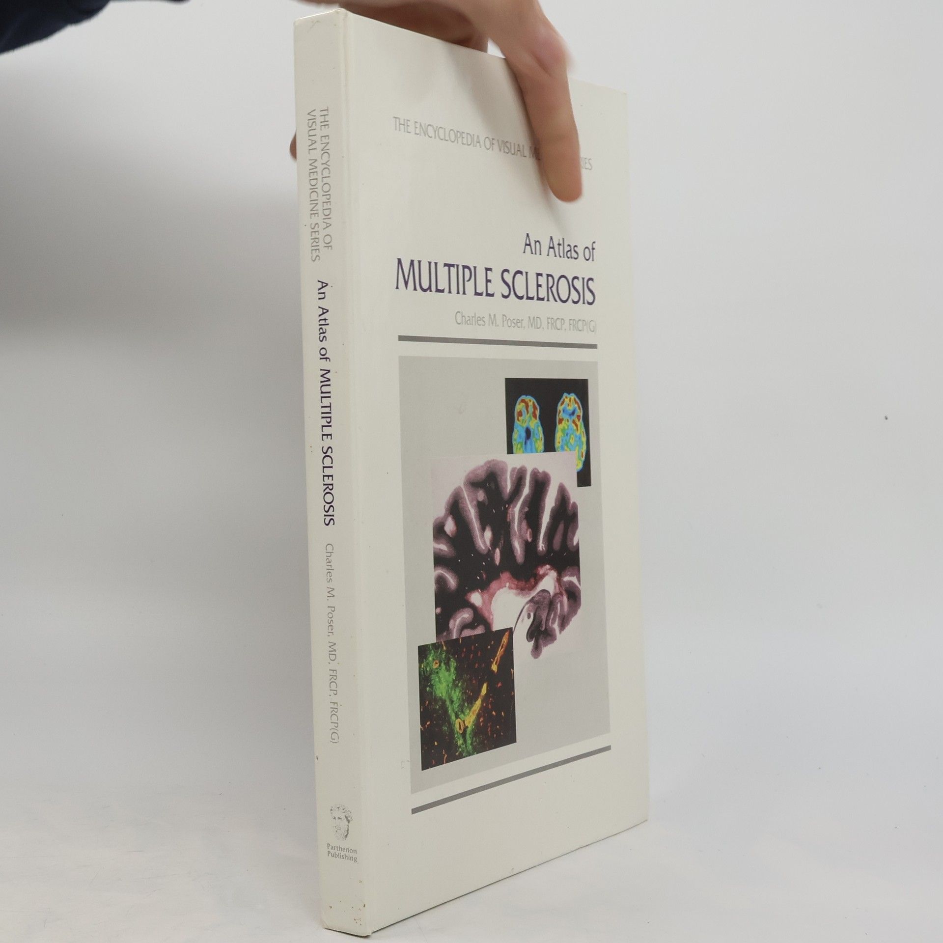 Charles M. Poser An Atlas of Multiple Sclerosis