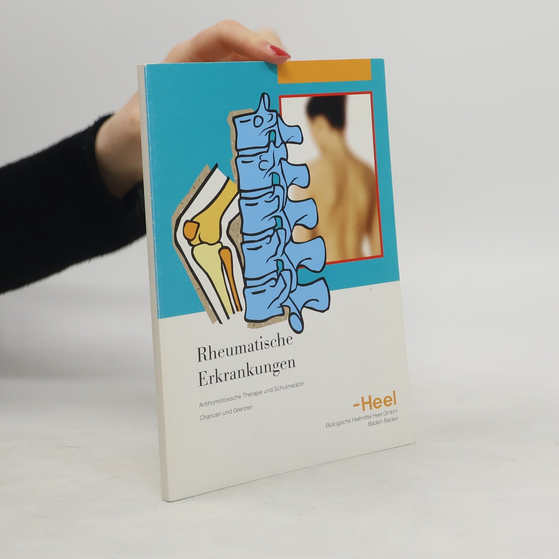 B. Potrafki Rheumatische Erkrankungen