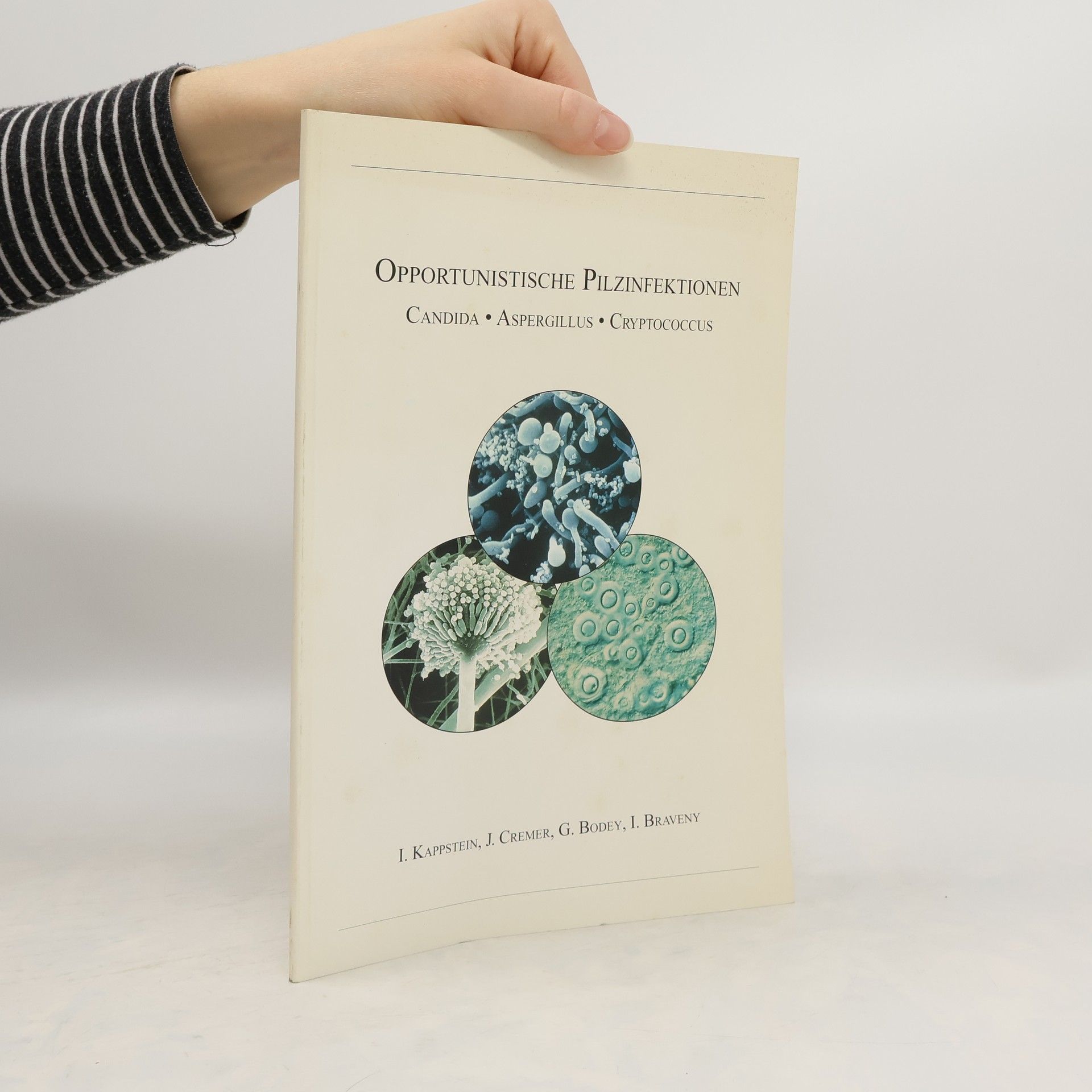 Collectif d'auteurs Opportunistische Pilzinfektionen