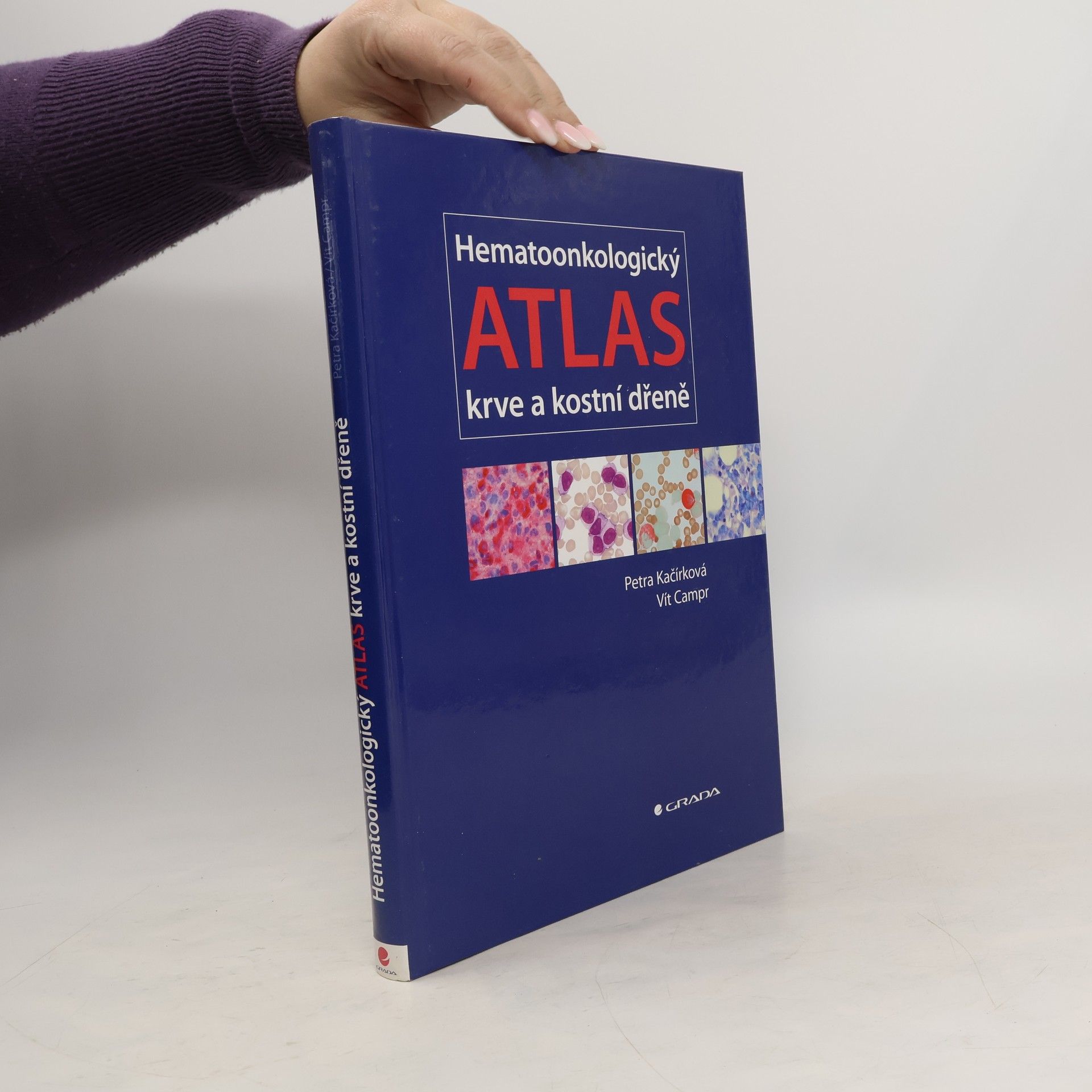 Petra Kačírková Hematoonkologický atlas krve a kostní dřeně