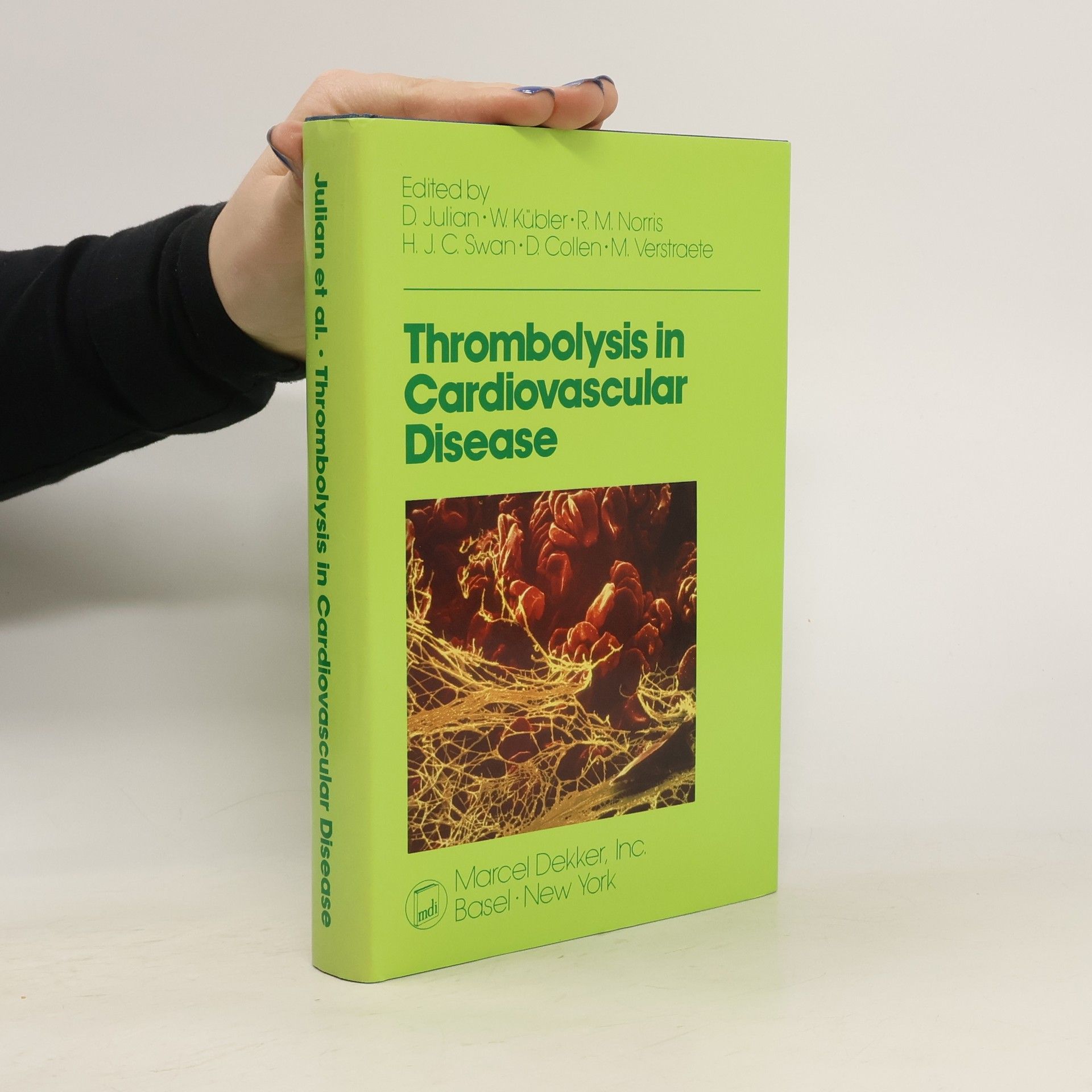 AA.VV. Thrombolysis in Cardiovascular Disease