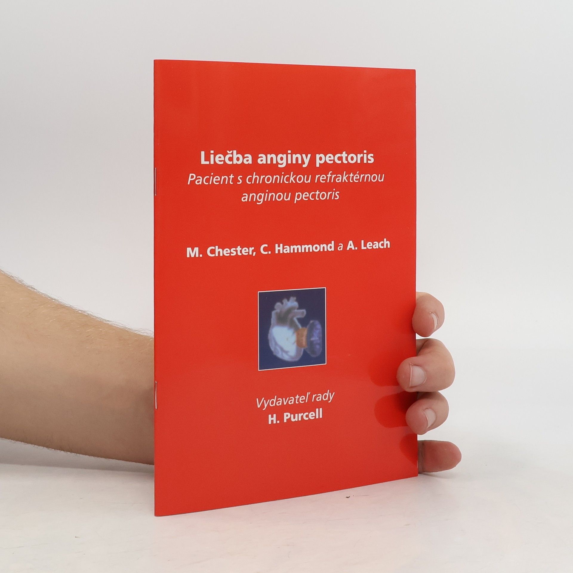 Auteurscollectief Liečba anginy pectoris. Pacient s chronickou refraktérnou anginou pectoris