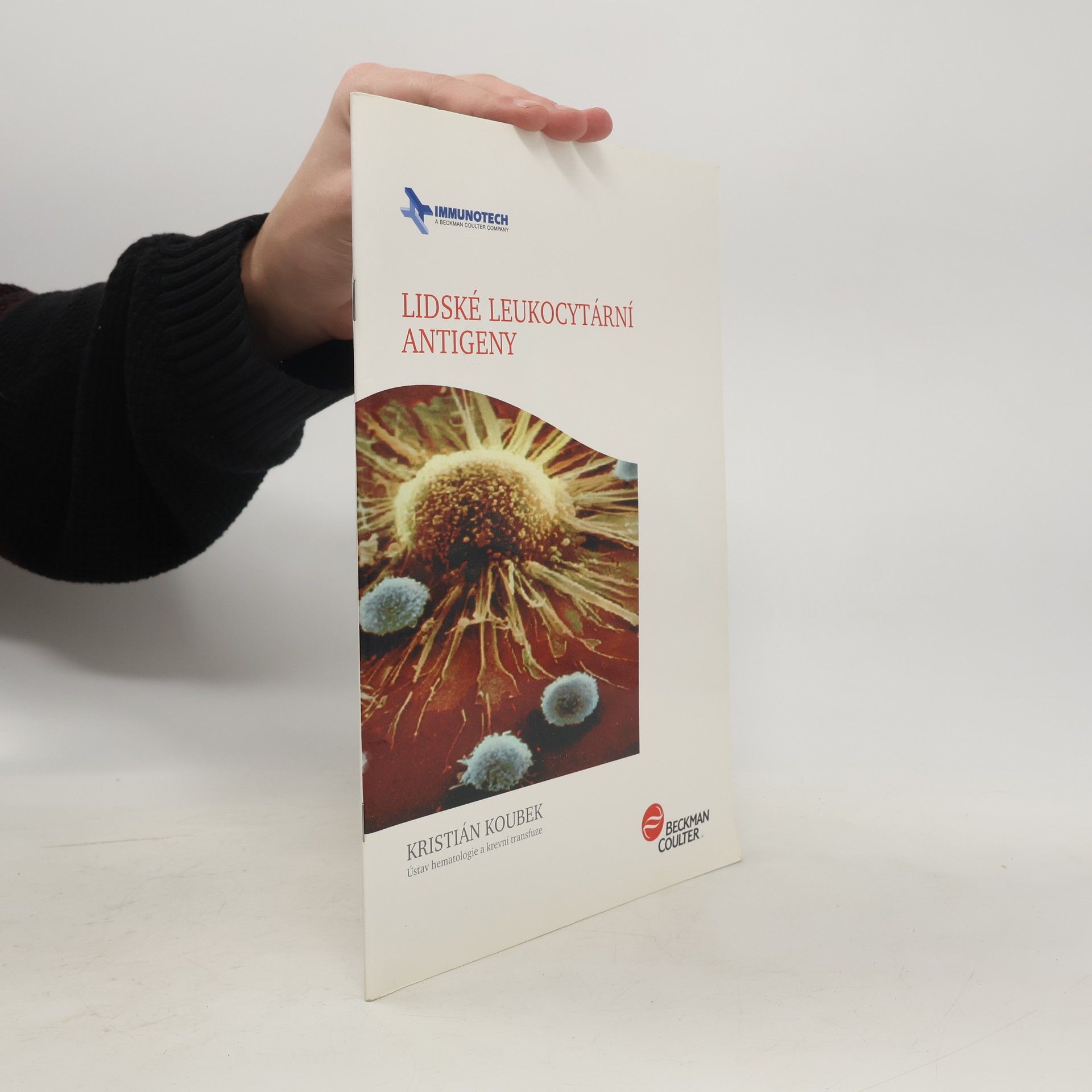 Lidské leukocytární antigeny