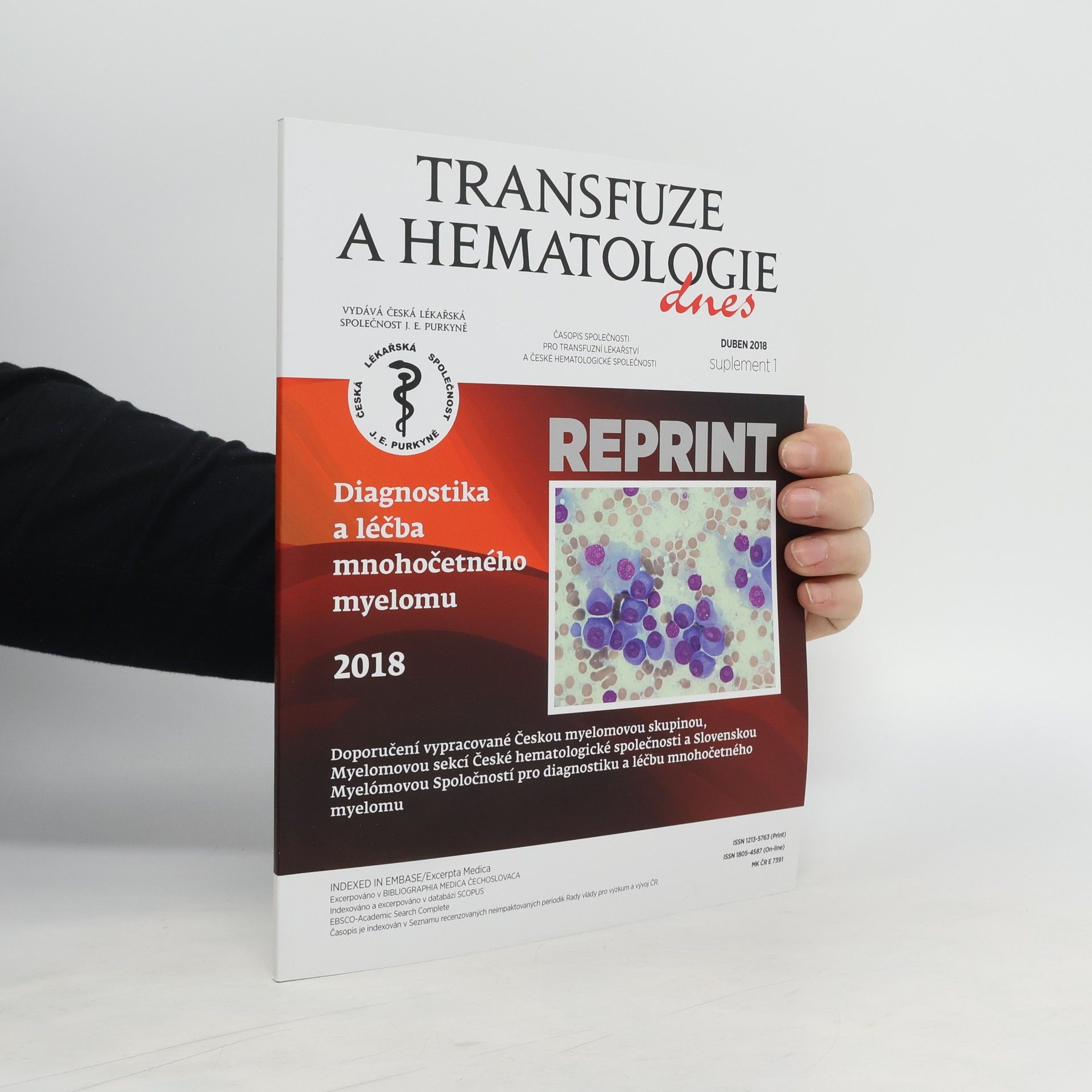 Auteurscollectief Diagnostika a léčba mnohočetného myelomu: Transfuze a hematologie 4/2018