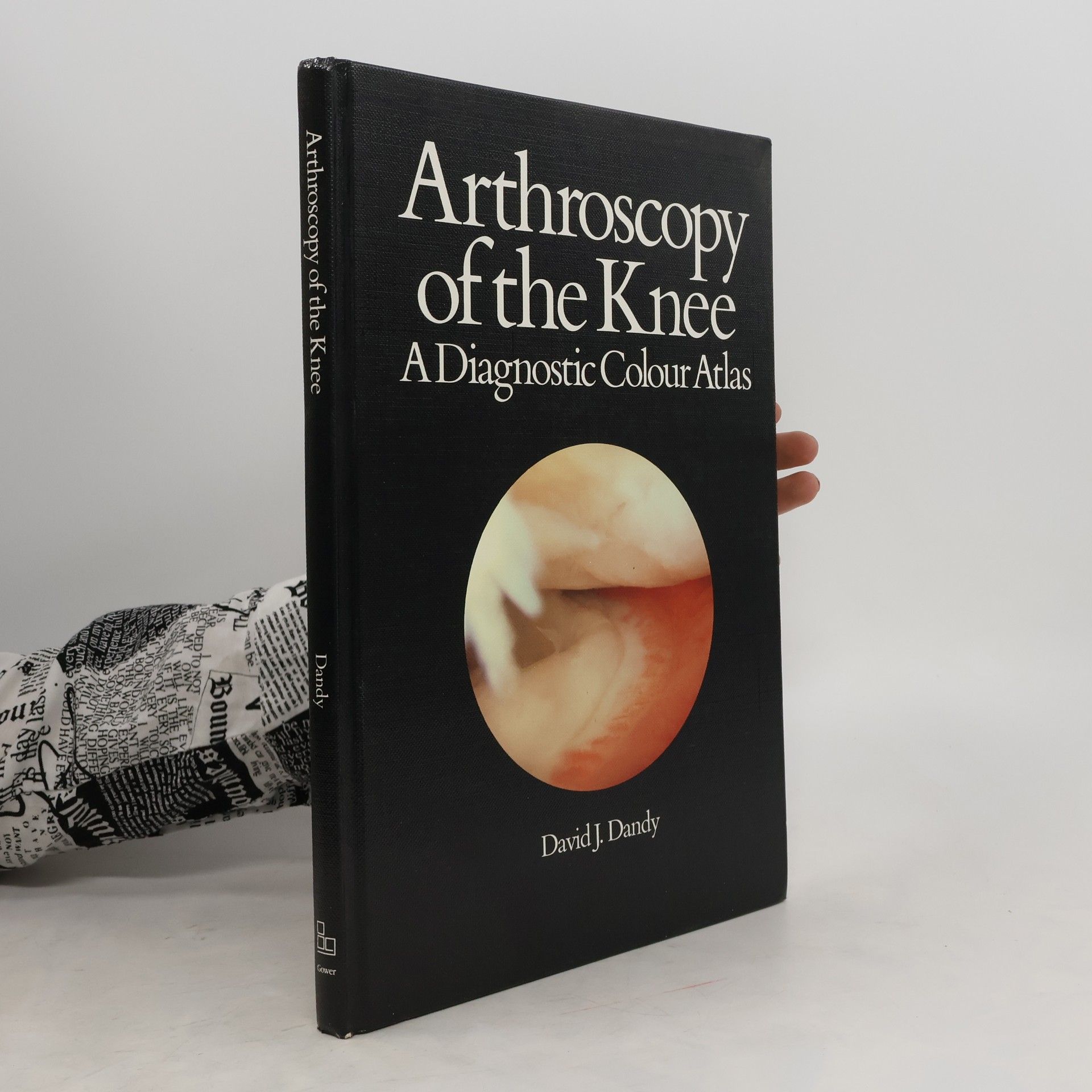 David J. Dandy Arthroscopy of the Knee