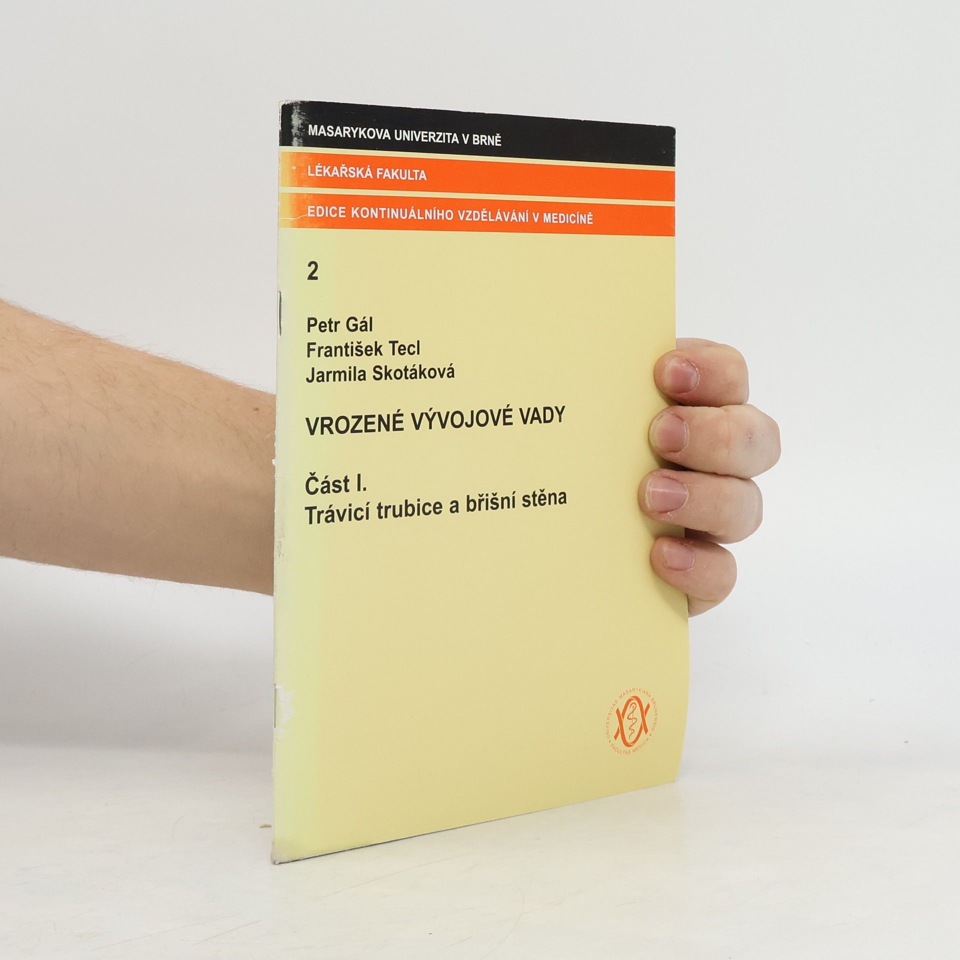 Vrozené vývojové vady