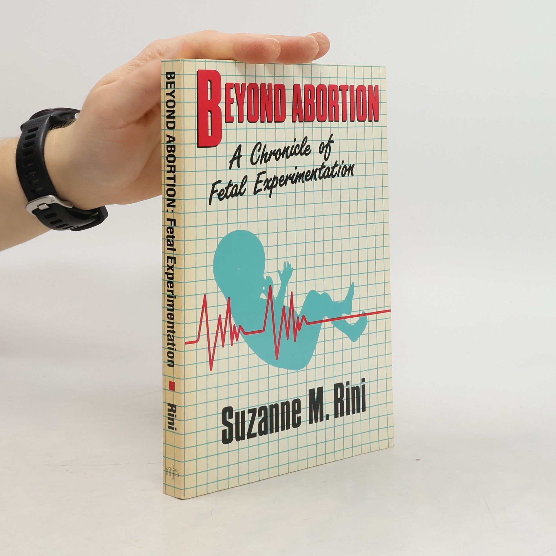 Suzanne M. Rini Beyond Abortion. A Chronicle of Fetal Experimentation
