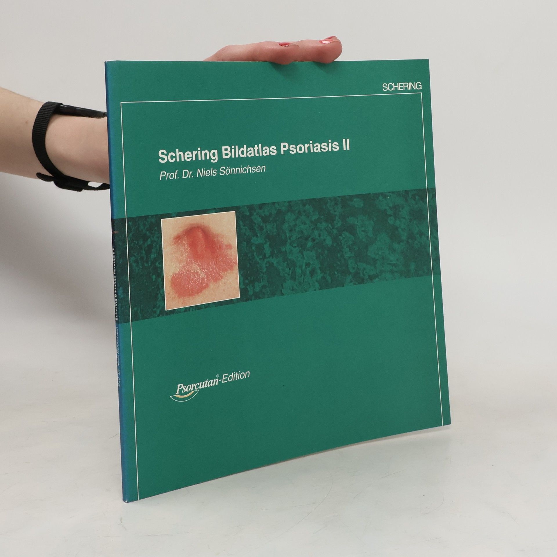 Niels Sönnichsen Schering Bildatlas Psoriasis II
