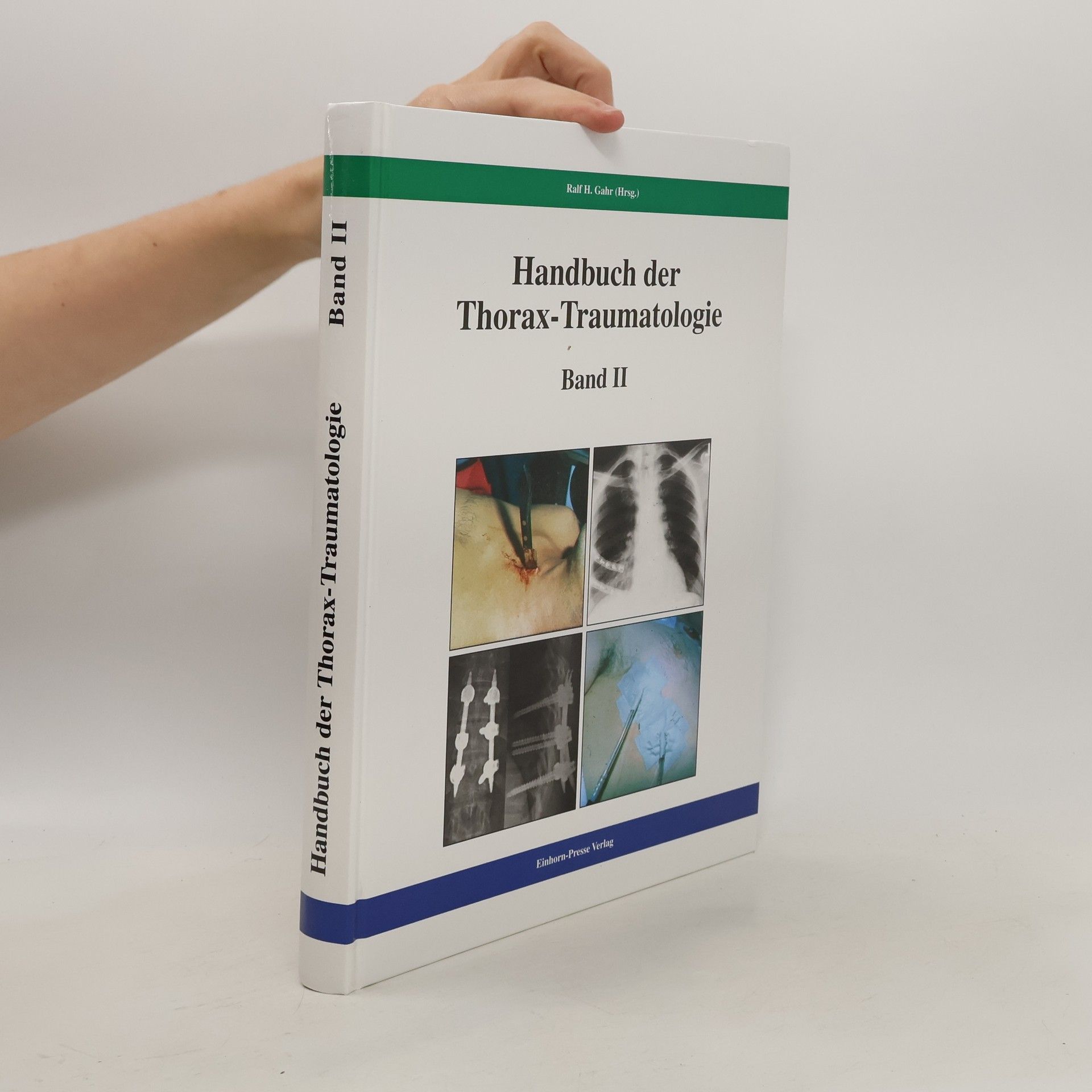 Auteurscollectief Handbuch der Thorax-Traumatologie