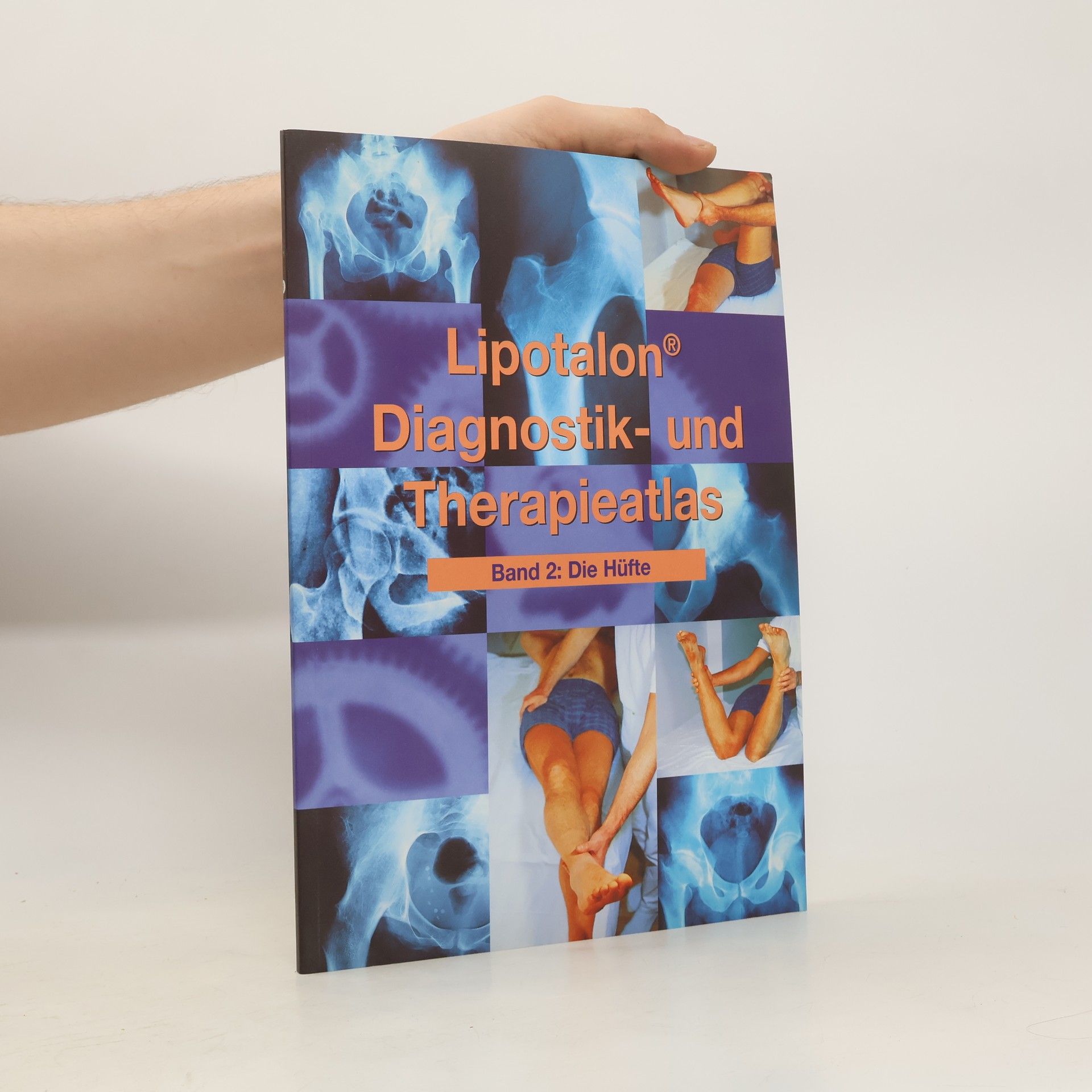Autorenkollektiv Lipotalon Diagnostik- und Therapieatlas Band 2