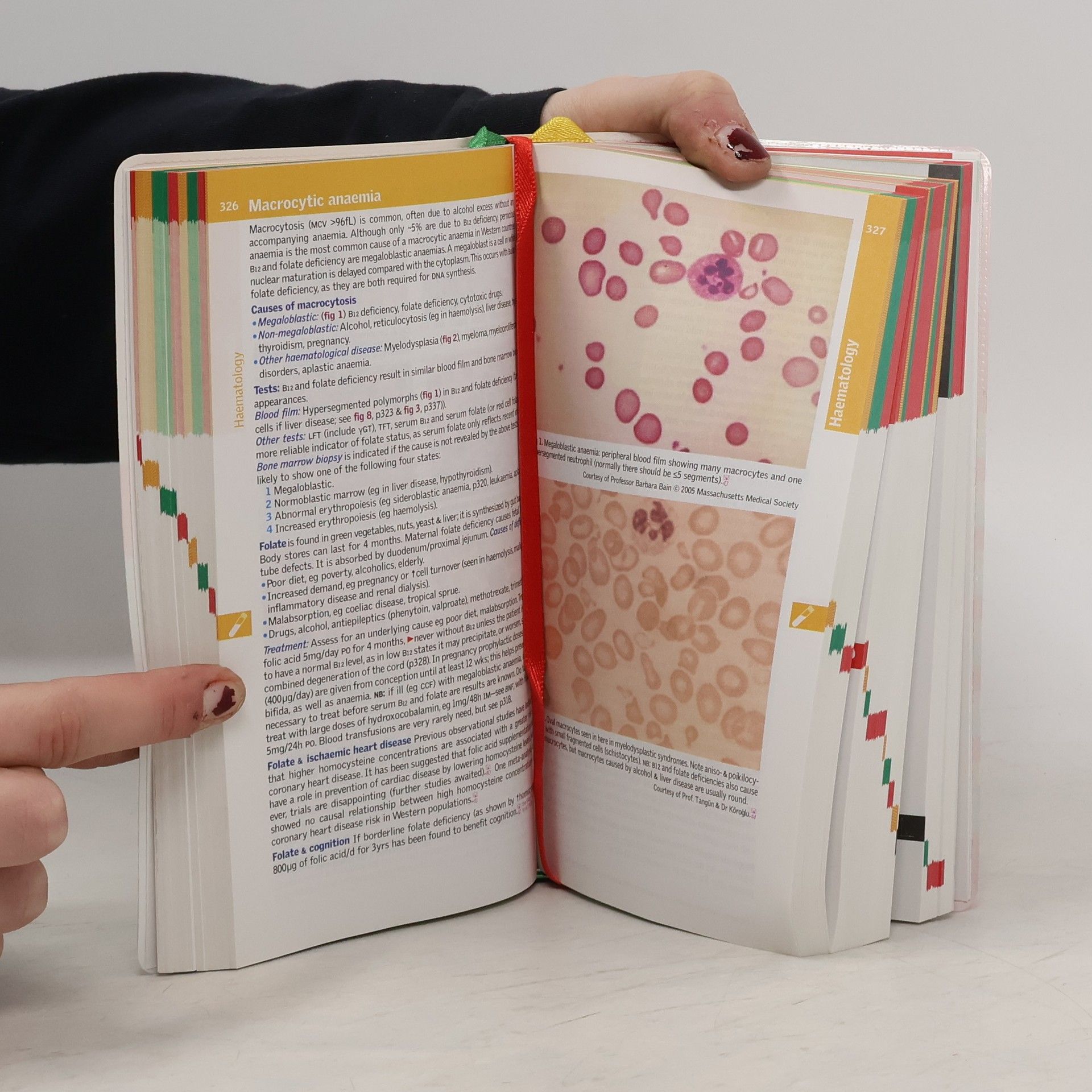 J. Murray Longmore Oxford handbook of clinical medicine