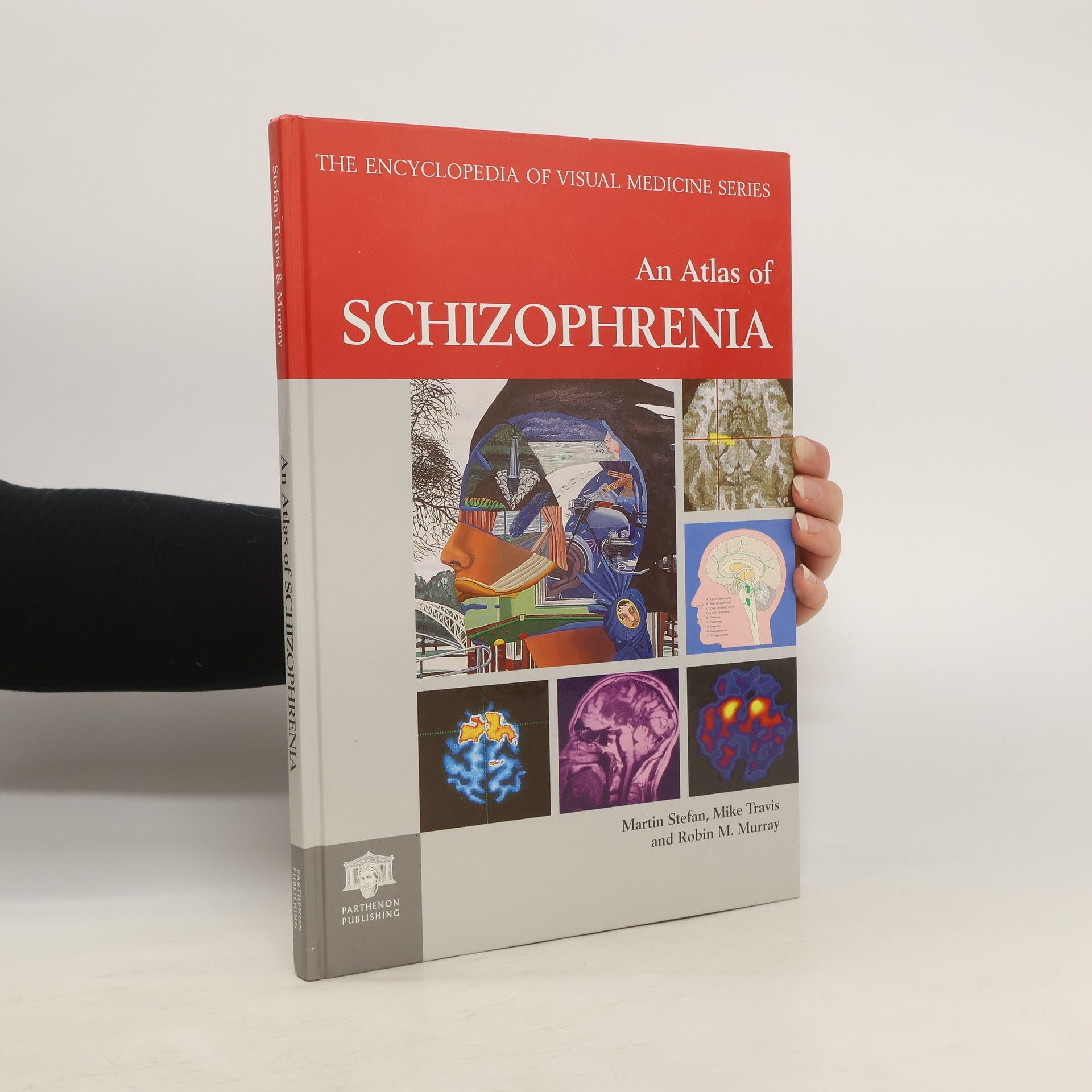 Stefan Martin The Encyclopedia of Visual Medicine Series. An Atlas of Schizophrenia