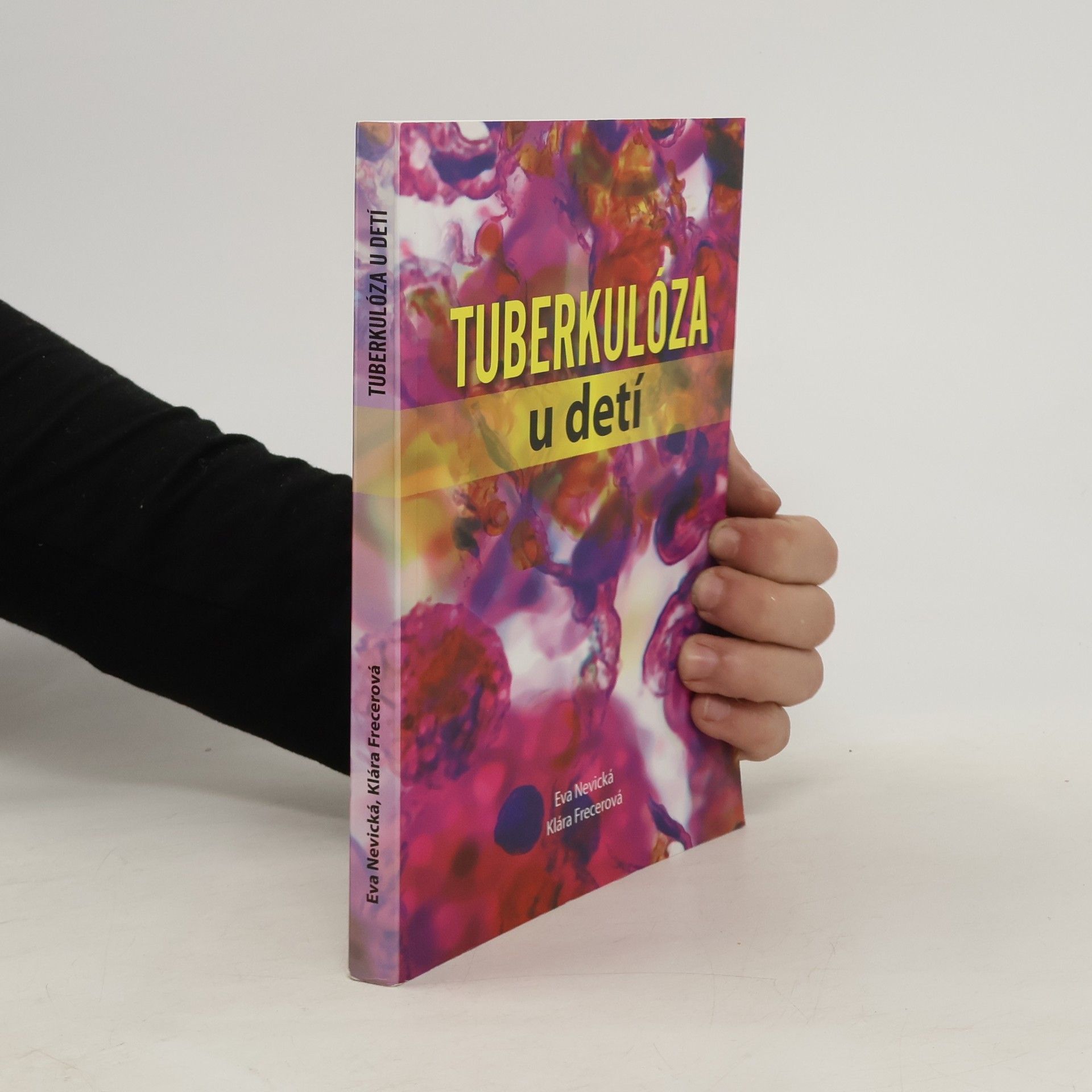 Auteurscollectief Tuberkulóza u detí