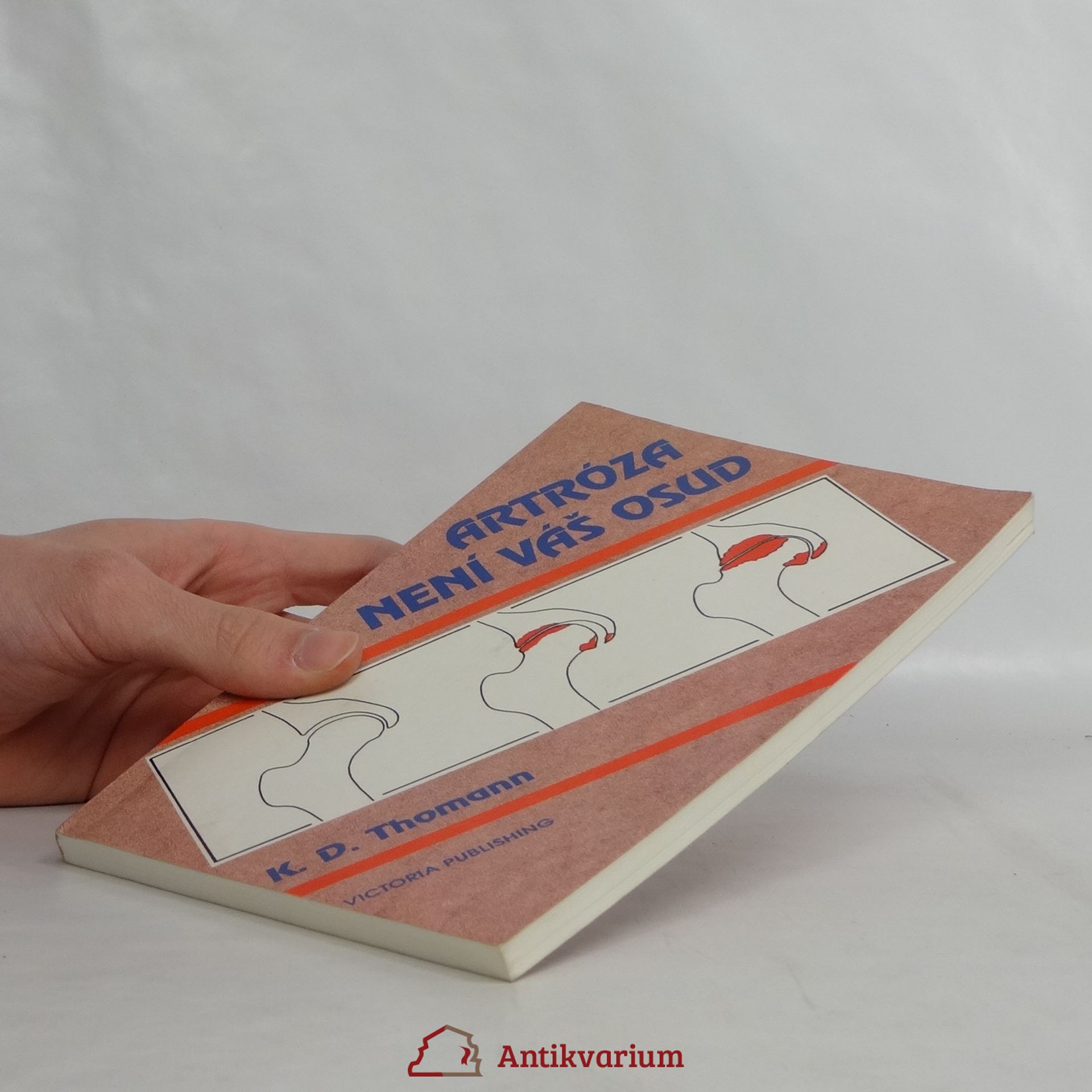 Klaus Dieter Thomann Artróza není váš osud