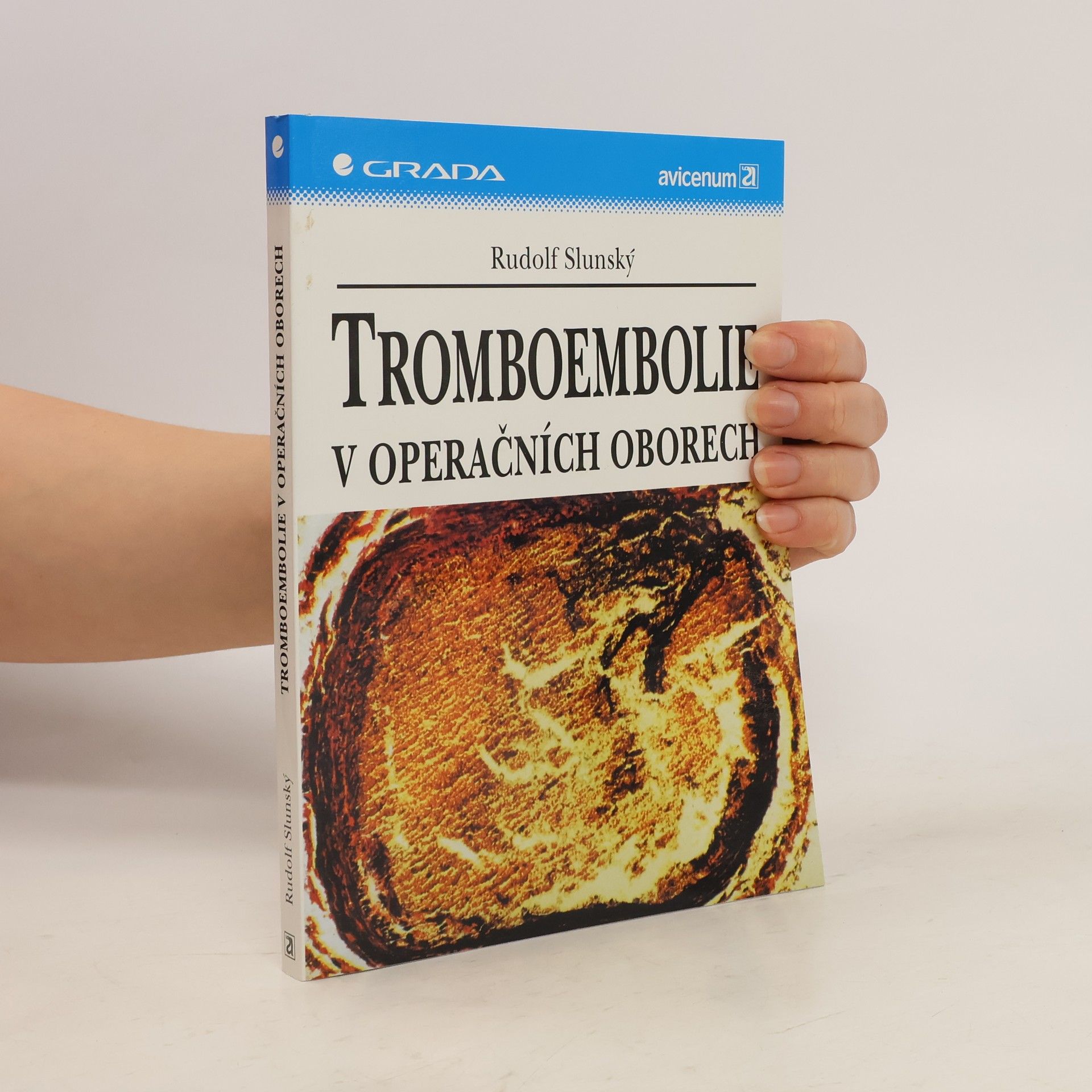 Rudolf Slunský Tromboembolie v operačních oborech