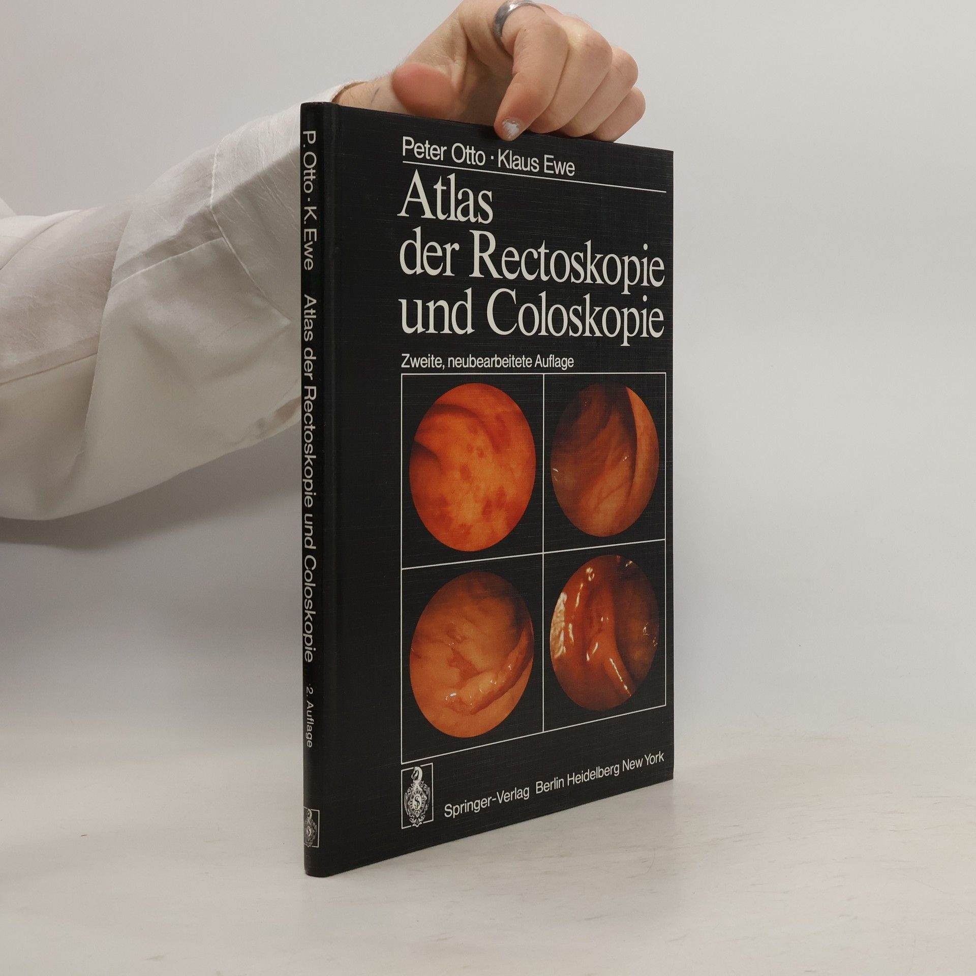 Klaus Ewen Atlas der Rectoskopie und Coloskopie