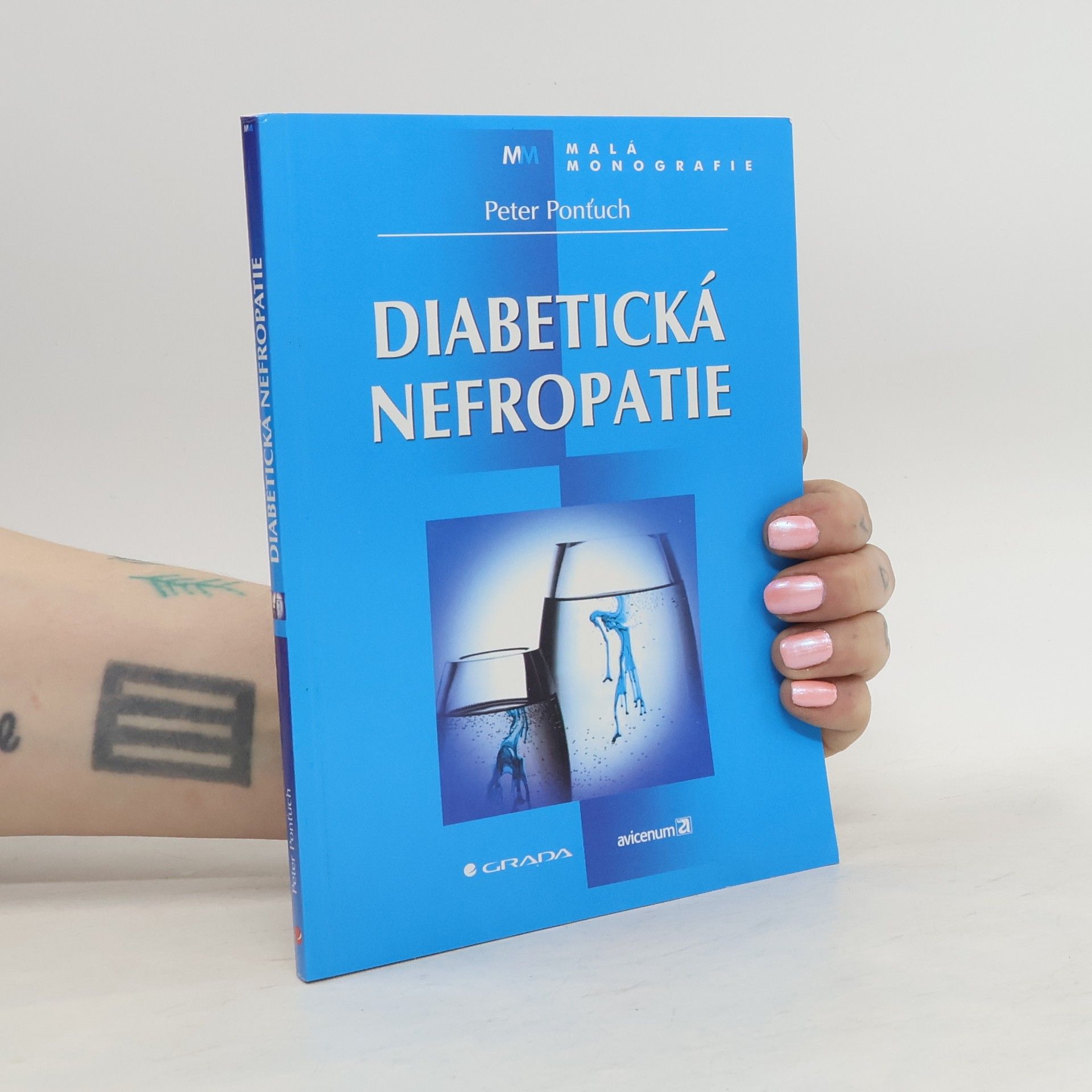 Peter Ponťuch Diabetická nefropatie