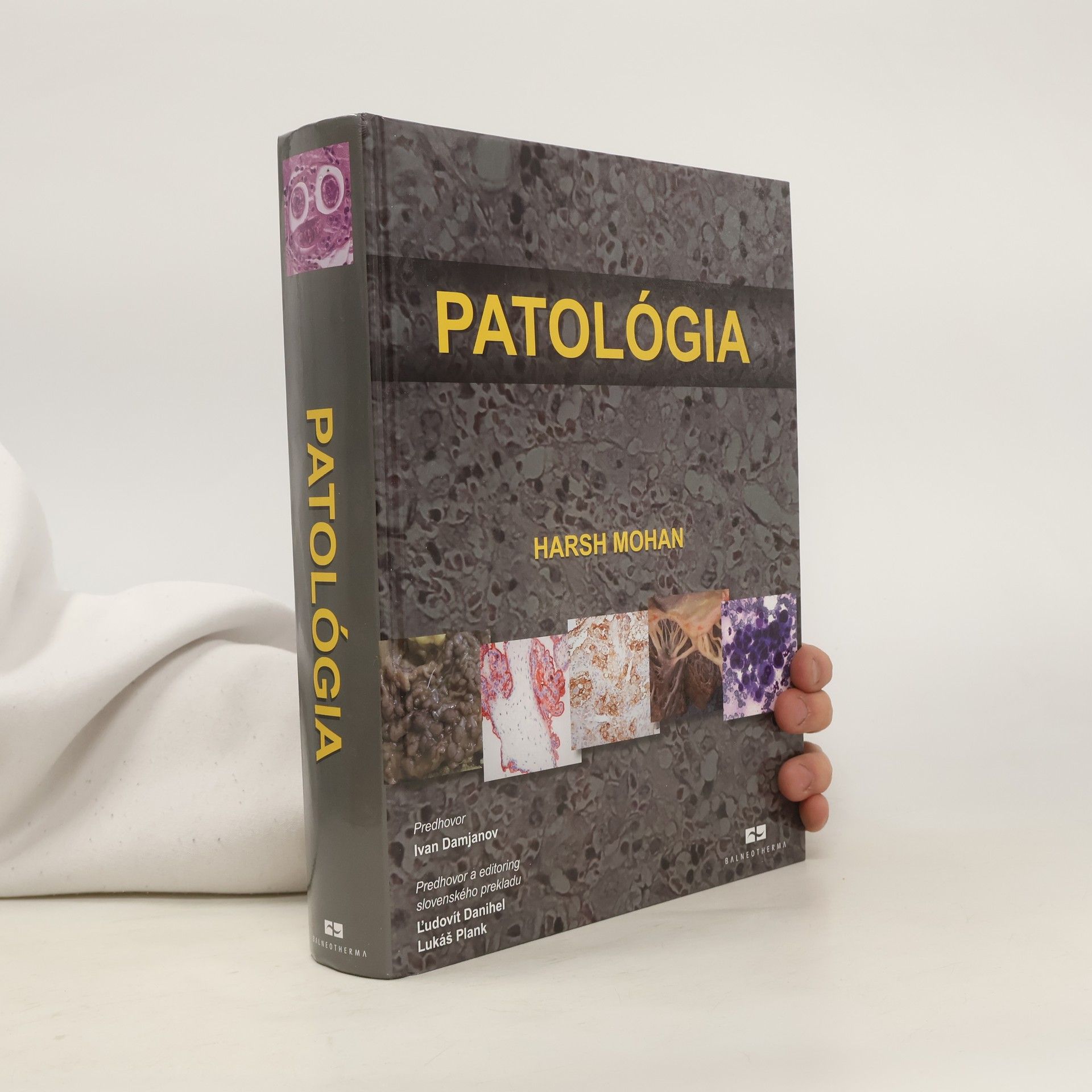 Harsh Mohan Patológia