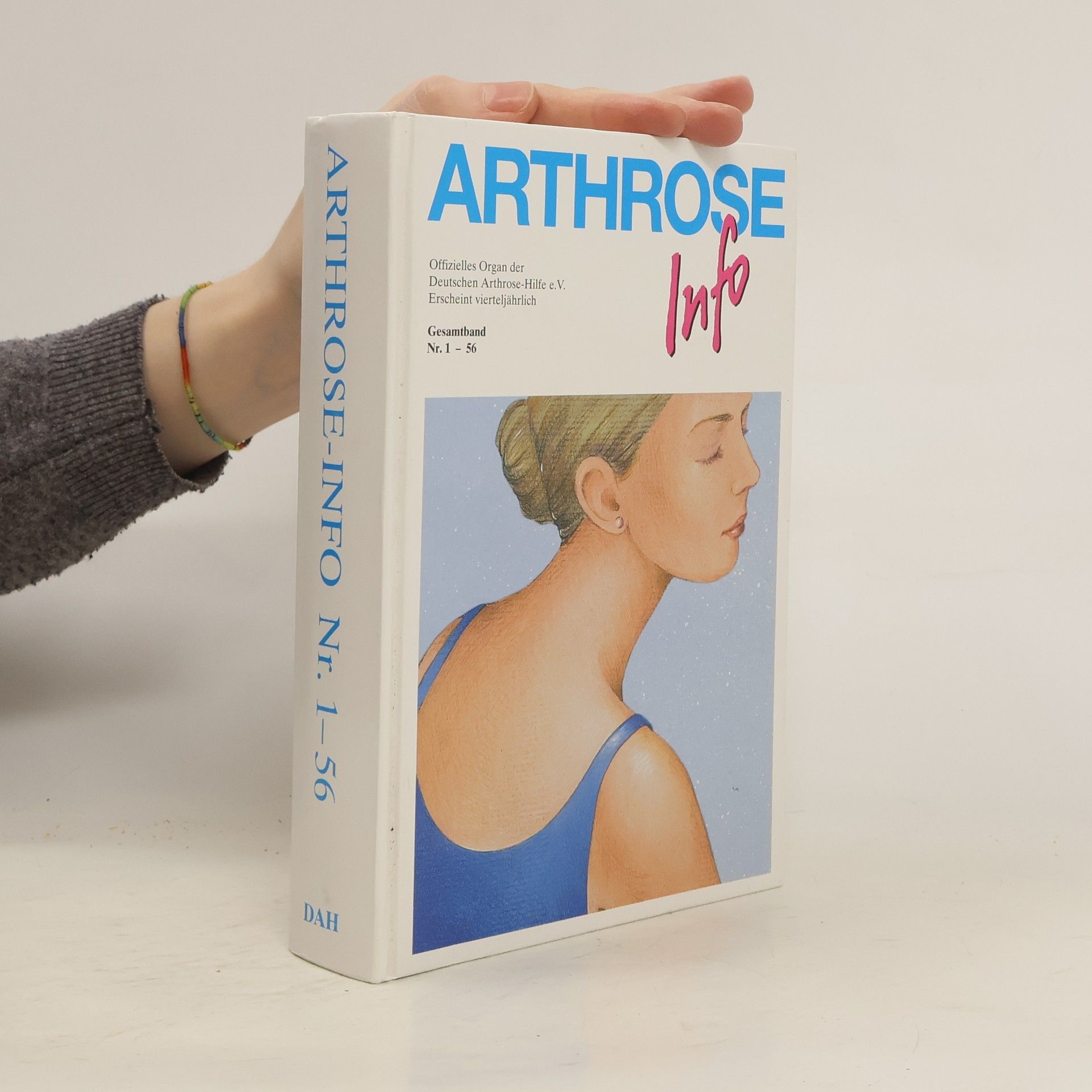 Autorenkollektiv Arthrose Info 1-56