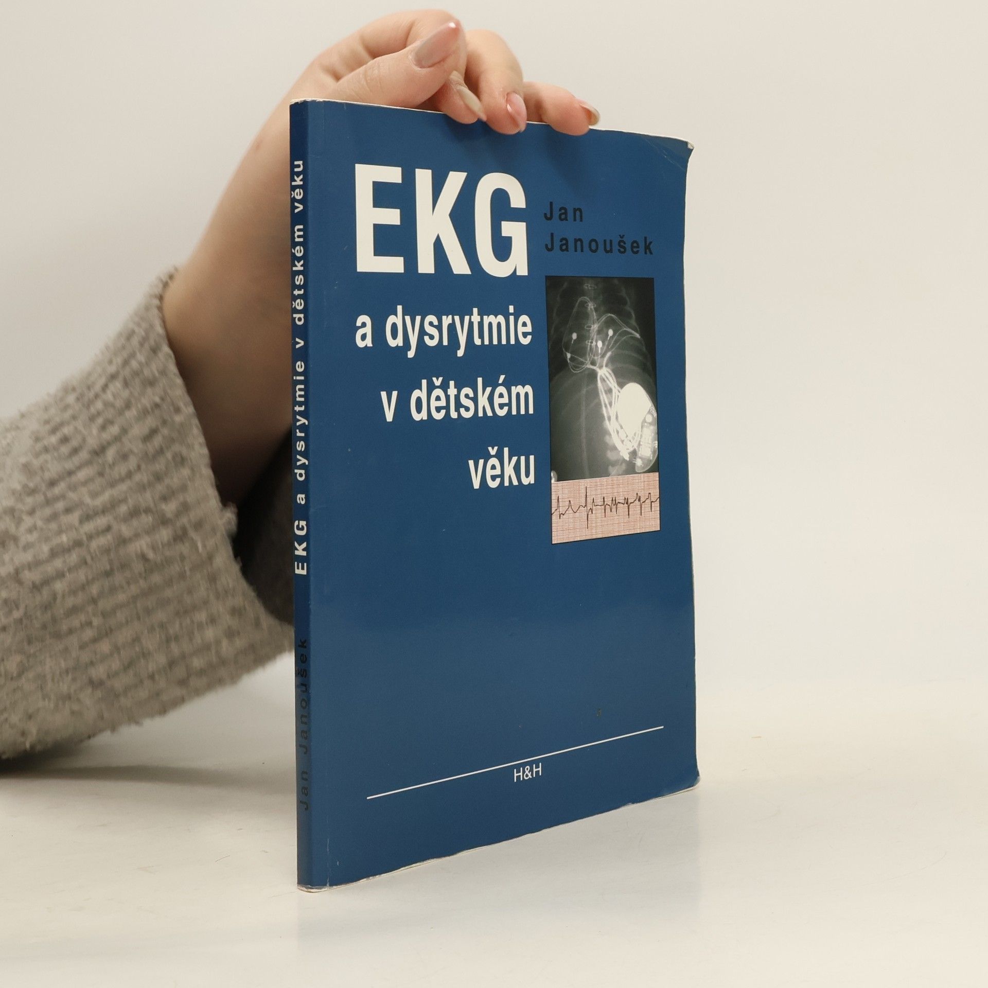 Jan Janoušek EKG a dysrytmie v dětském věku