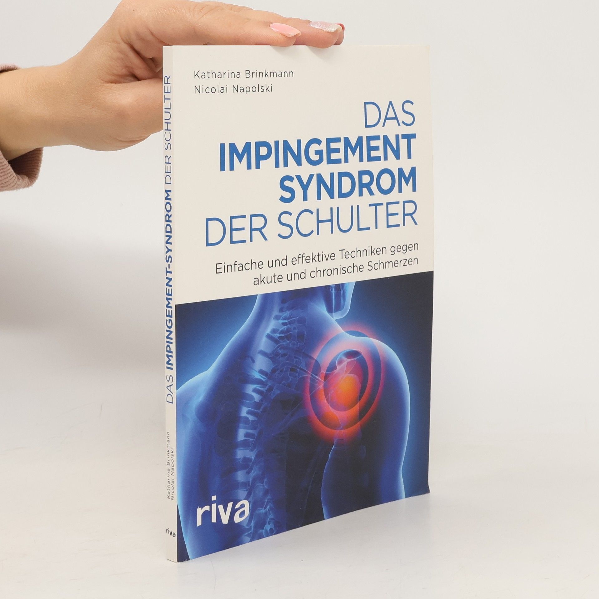 Katharina Brinkmann Das Impingement-Syndrom der Schulter