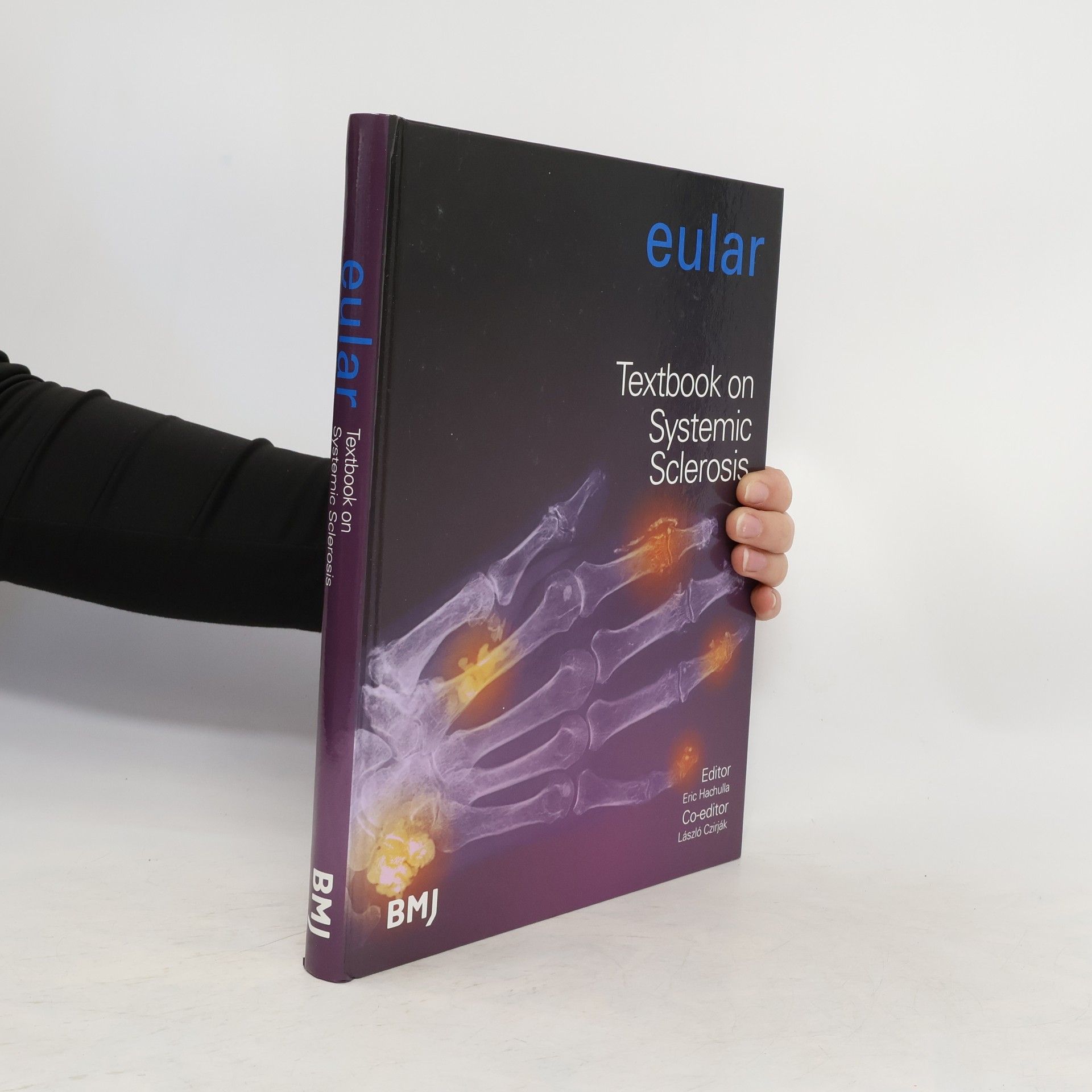 EULAR Textbook on systemic sclerosis