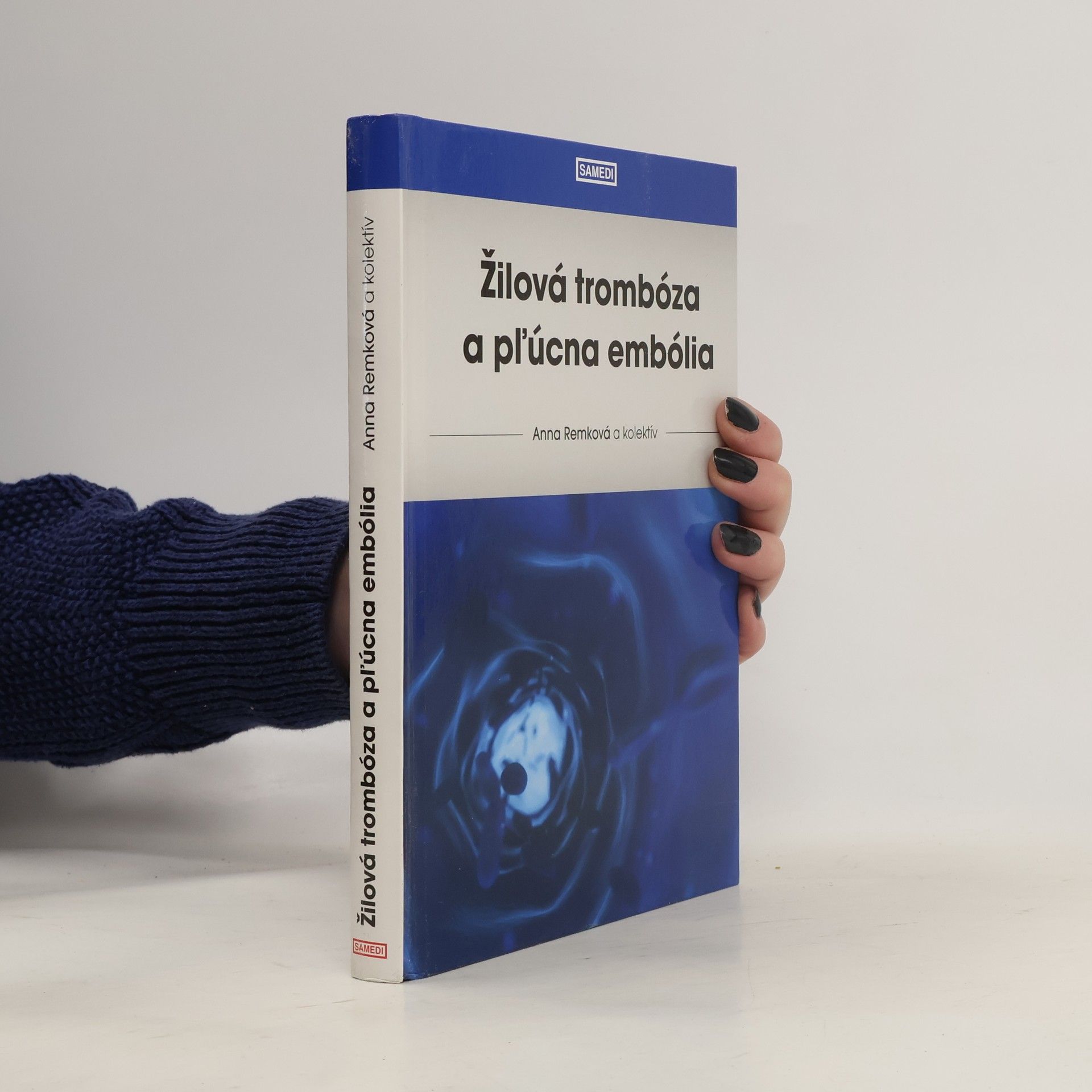 Žilová trombóza a pľúcna embólia