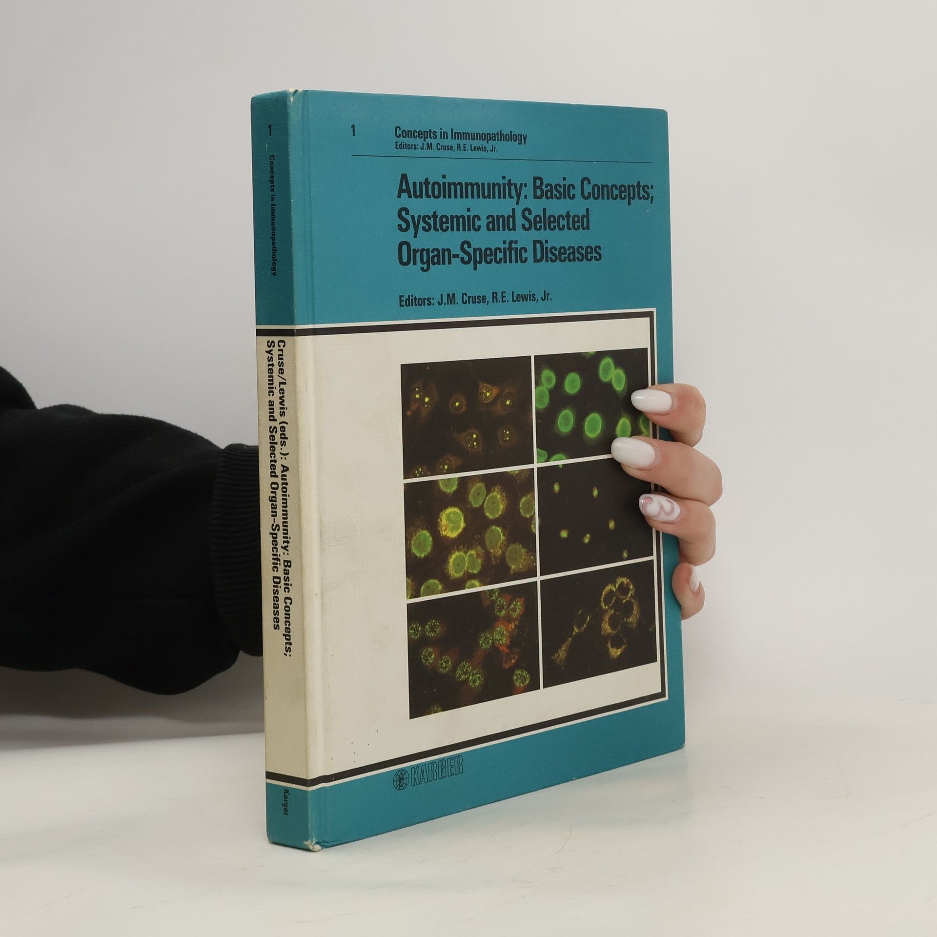 Julius M. Cruse Organ based autoimmune diseases