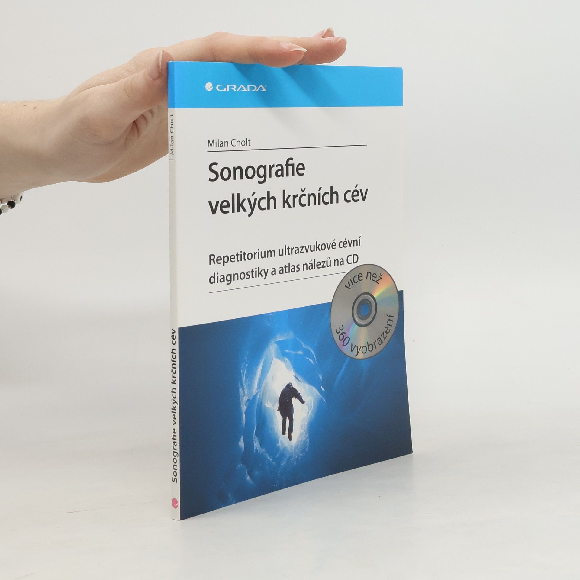 Milan Cholt Sonografie velkých krčních cév