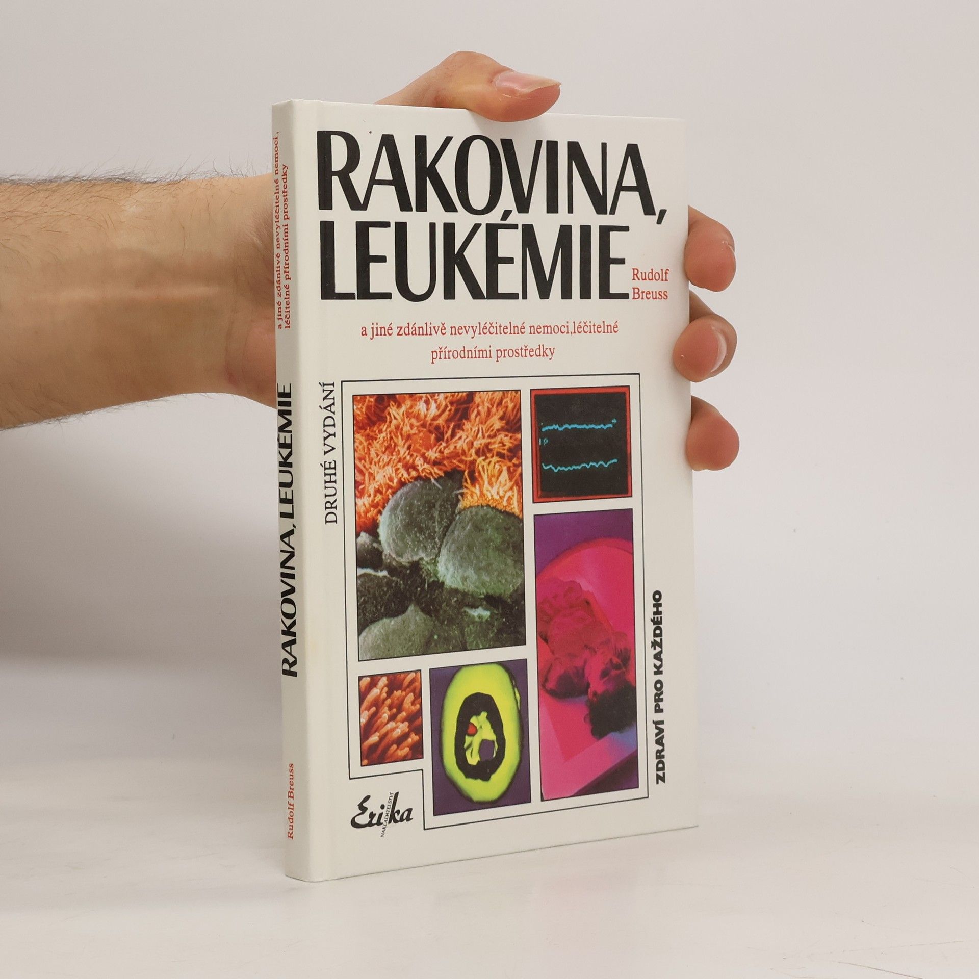 Rudolf Breuss Rakovina, leukémie a jiné zdánlivě nevyléčitelné nemoci, které jsou léčitelné přírodními prostředky: Záznamy z tisíců zkušeností k blahu všeho lidstva na přání mnoha vyléčených pacientů a také na přání dobrých lékařů