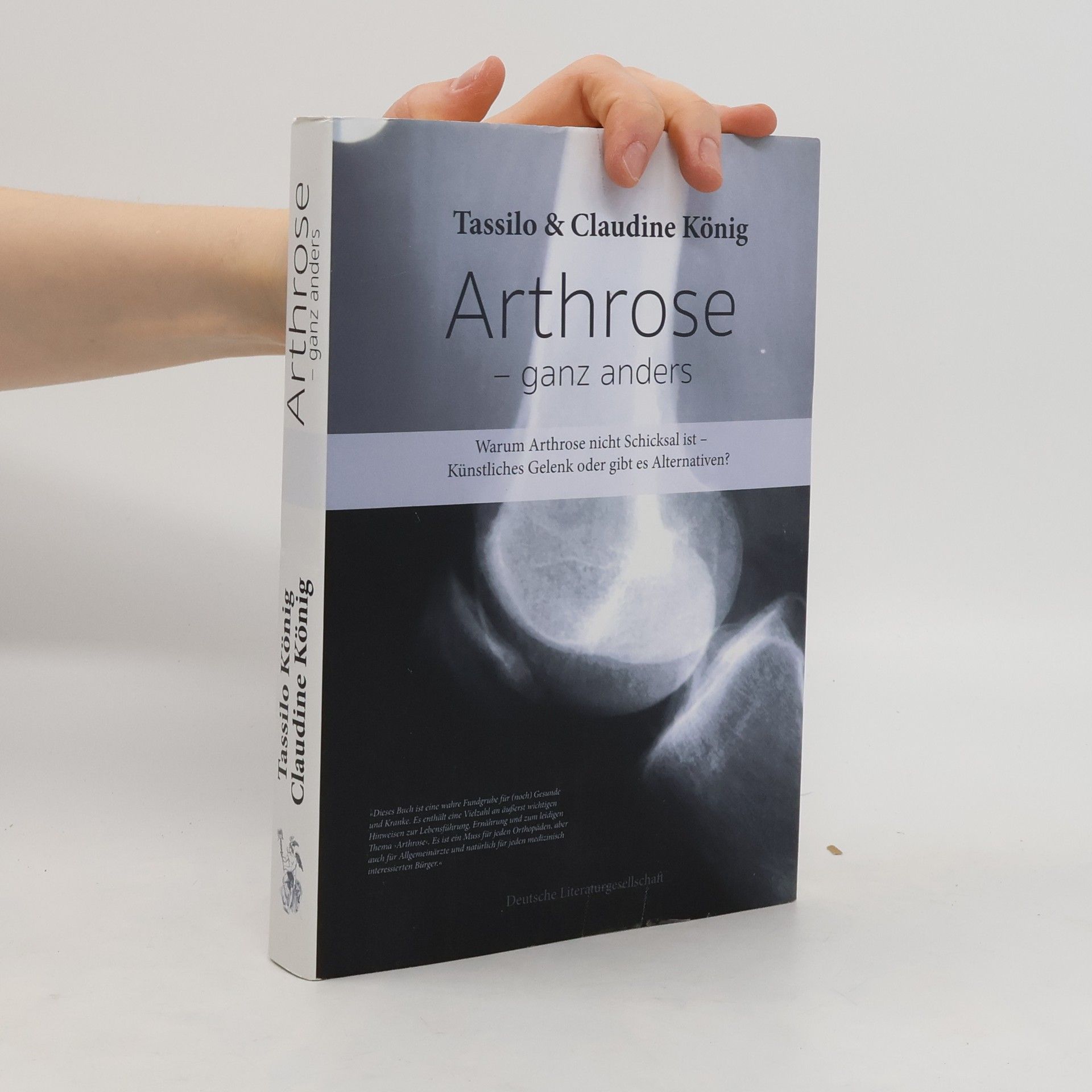 Tassilo König Arthrose - ganz anders