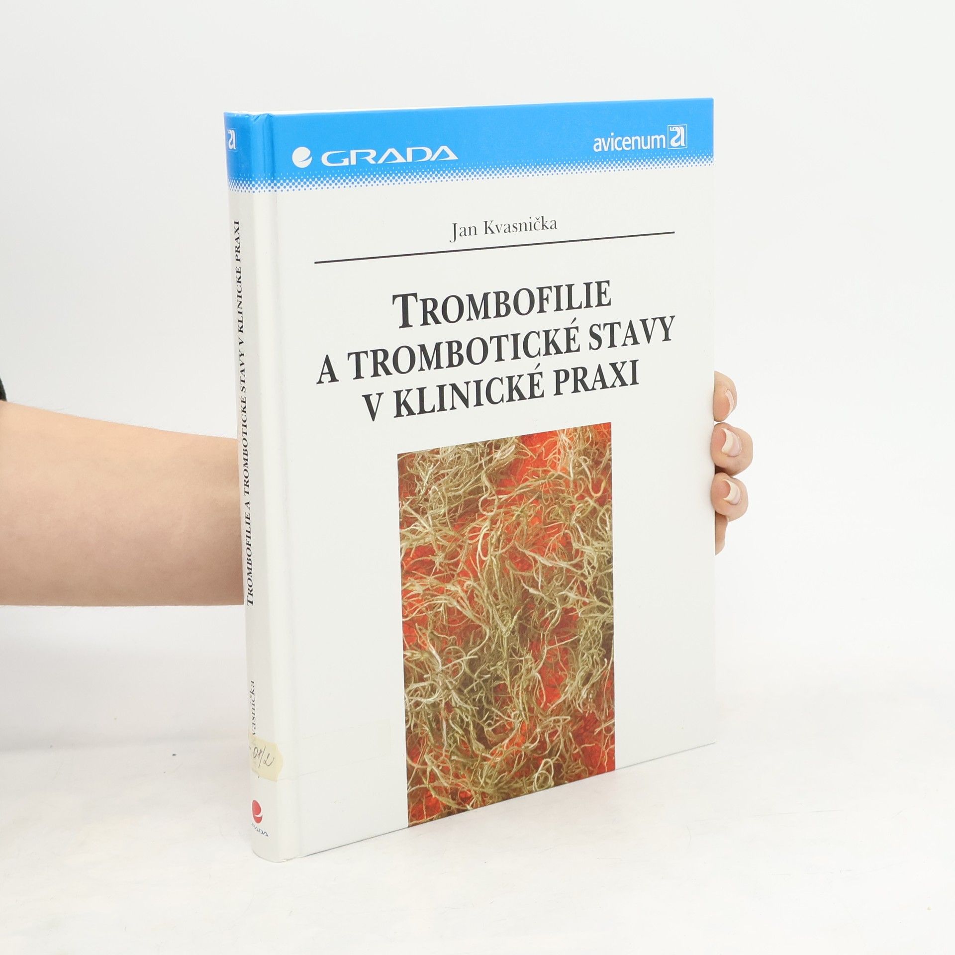 Jan Kvasnička Trombofilie a trombotické stavy v klinické praxi