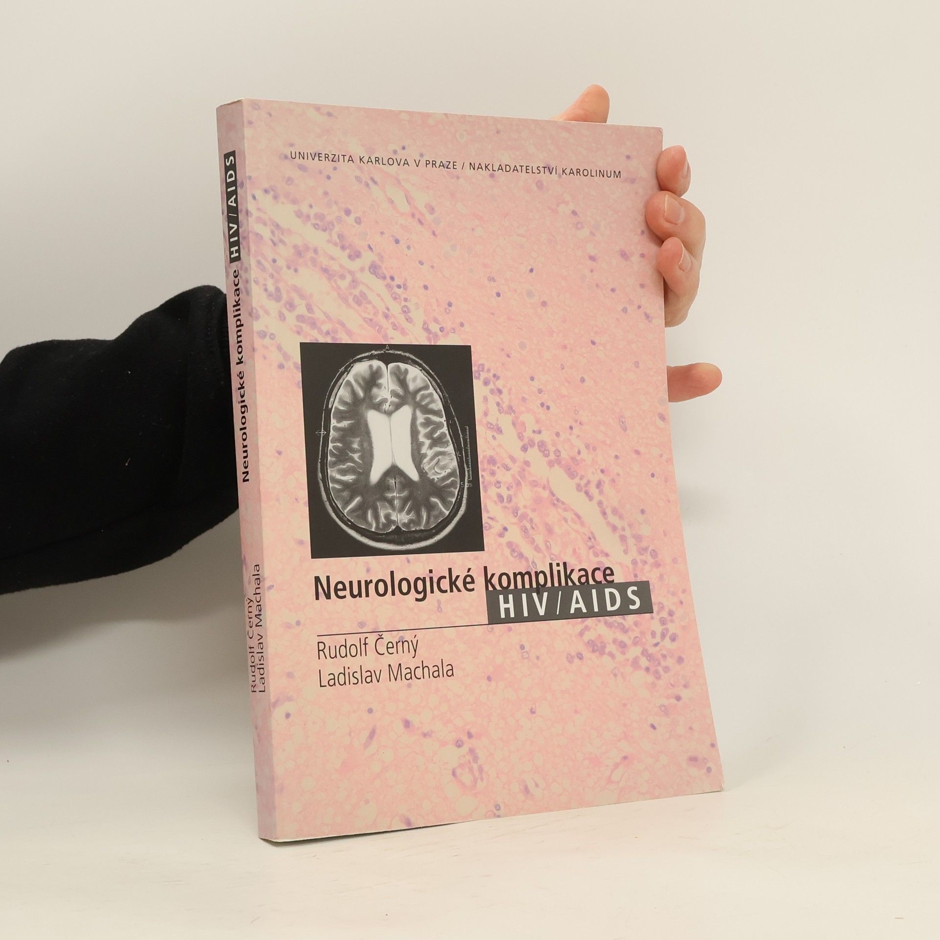 Ladislav Machala Neurologické komplikace HIV/AIDS