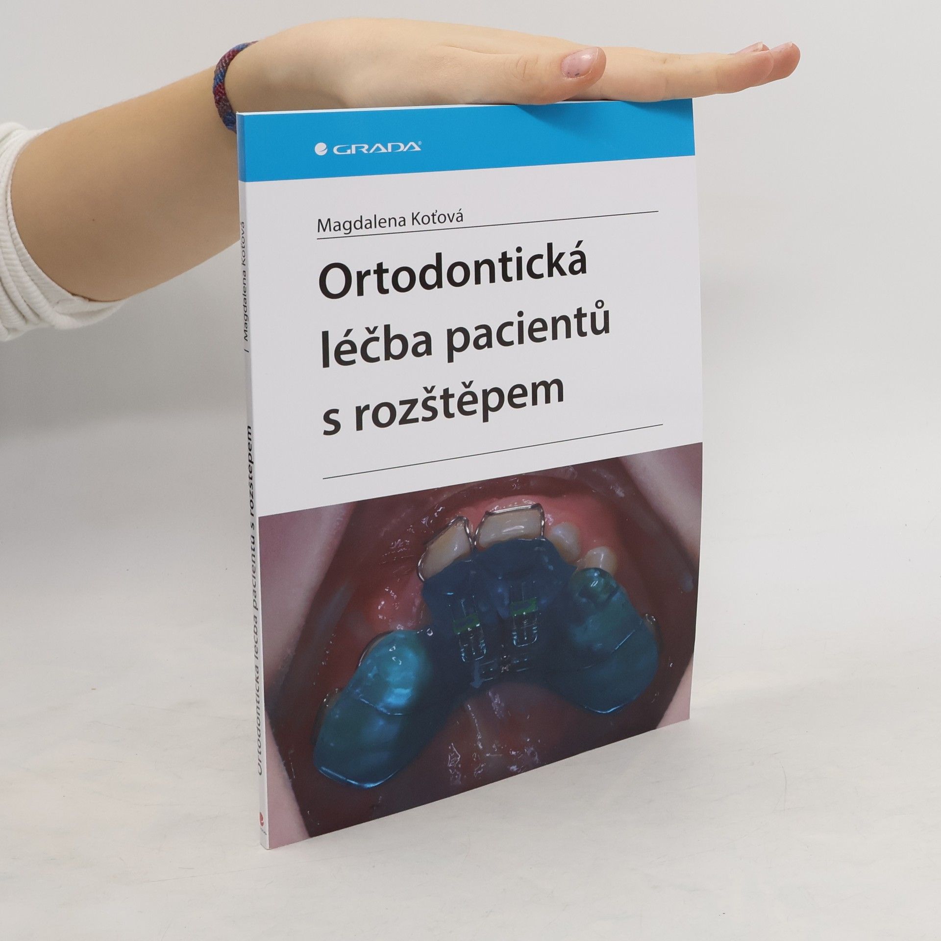 Magdalena Koťová Ortodontická léčba pacientů s rozštěpem