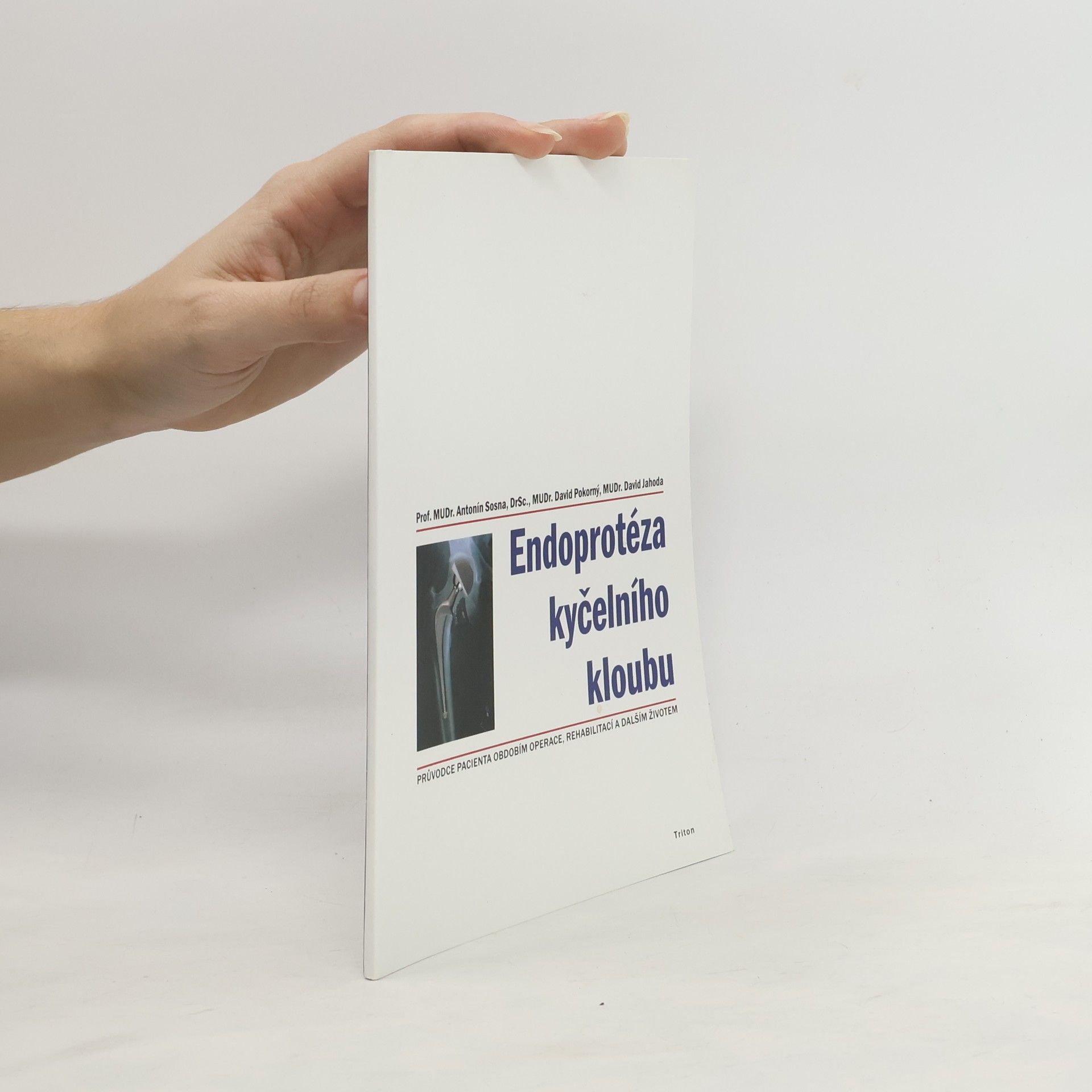 Antonín Sosna Endoprotéza kyčelního kloubu